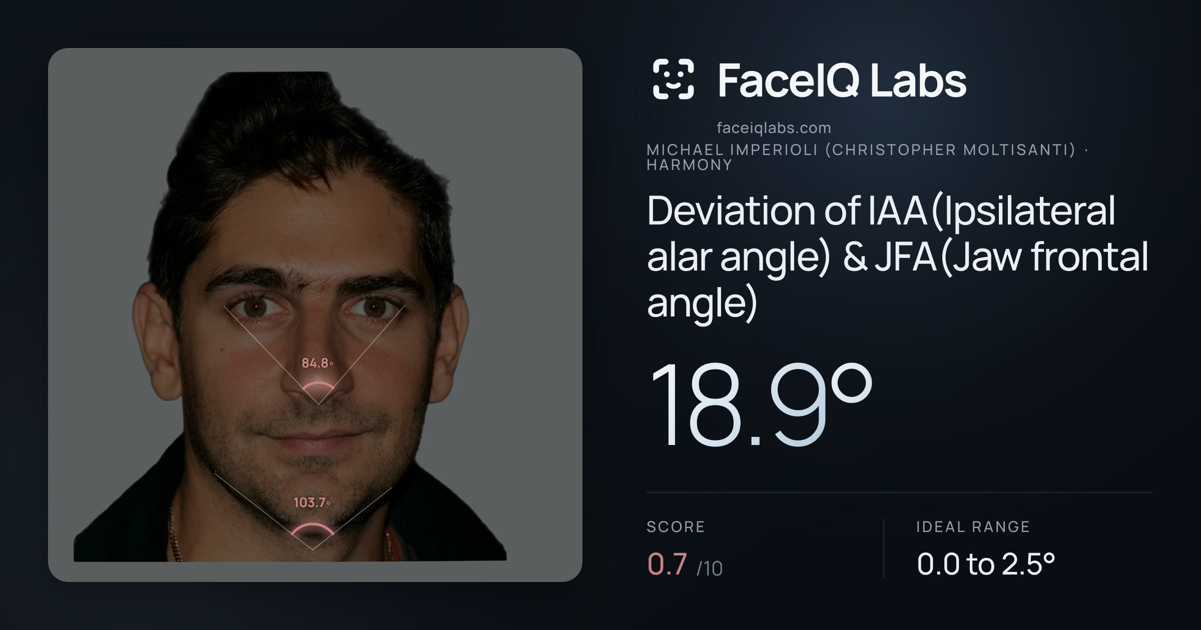 Michael Imperioli (Christopher Moltisanti) Deviation of IAA(Ipsilateral alar angle) & JFA(Jaw frontal angle): 18.9°, drawn on the photo