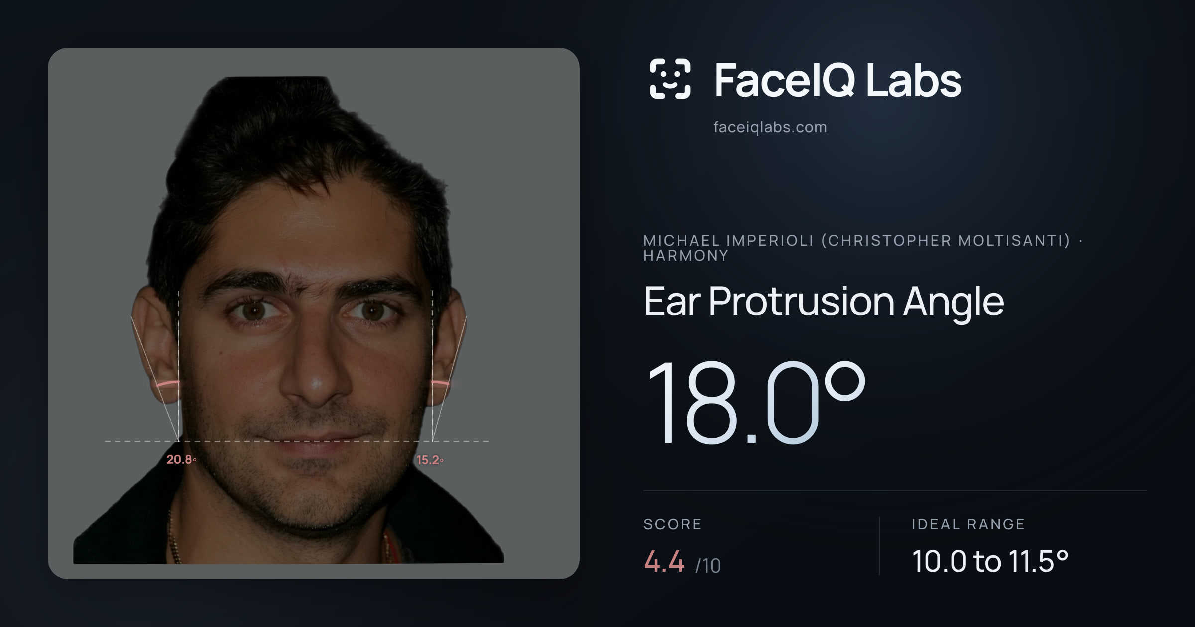 Michael Imperioli (Christopher Moltisanti) Ear Protrusion Angle: 18.0°, drawn on the photo