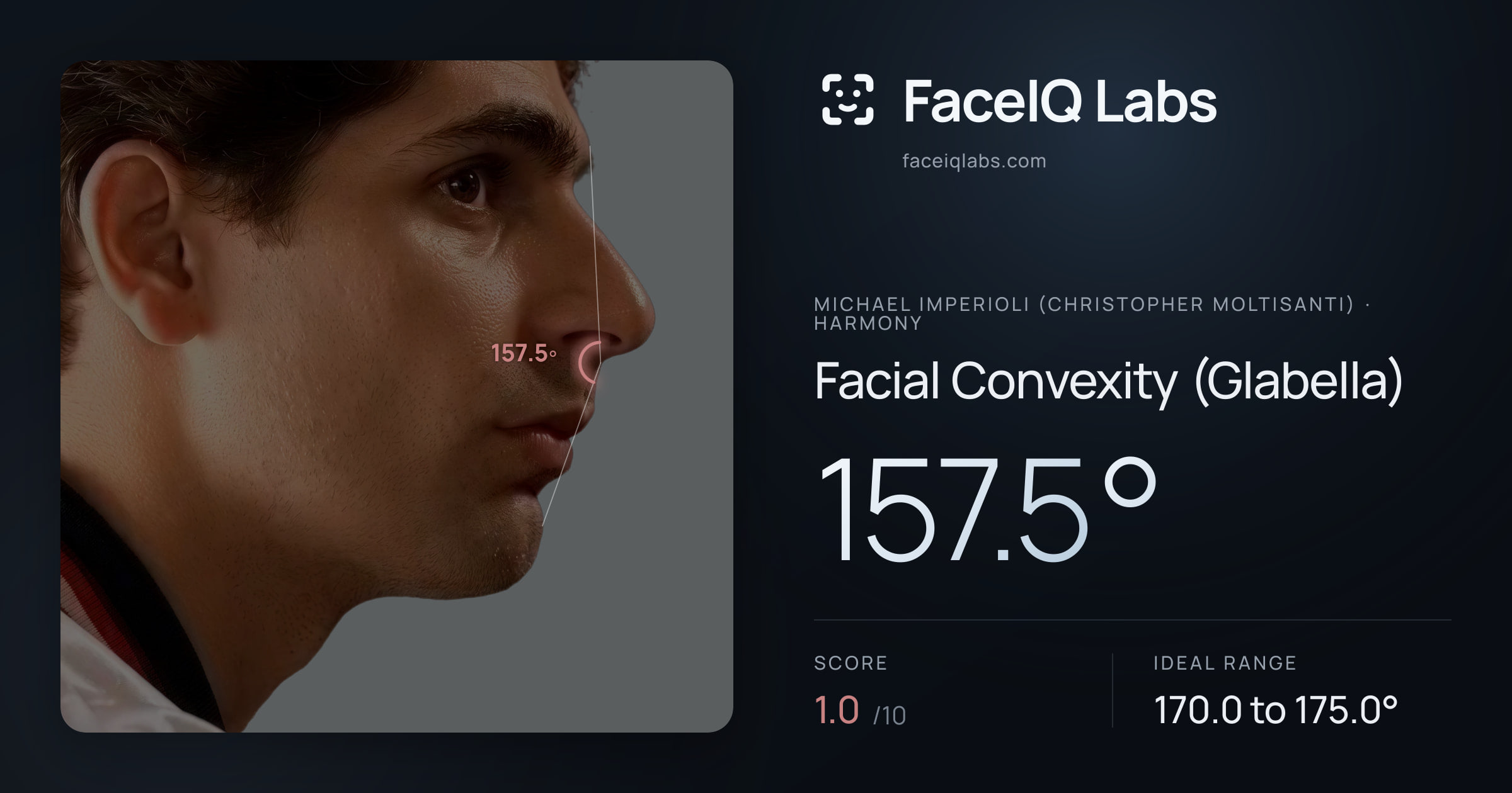 Michael Imperioli (Christopher Moltisanti) Facial Convexity (Glabella): 157.5°, drawn on the photo