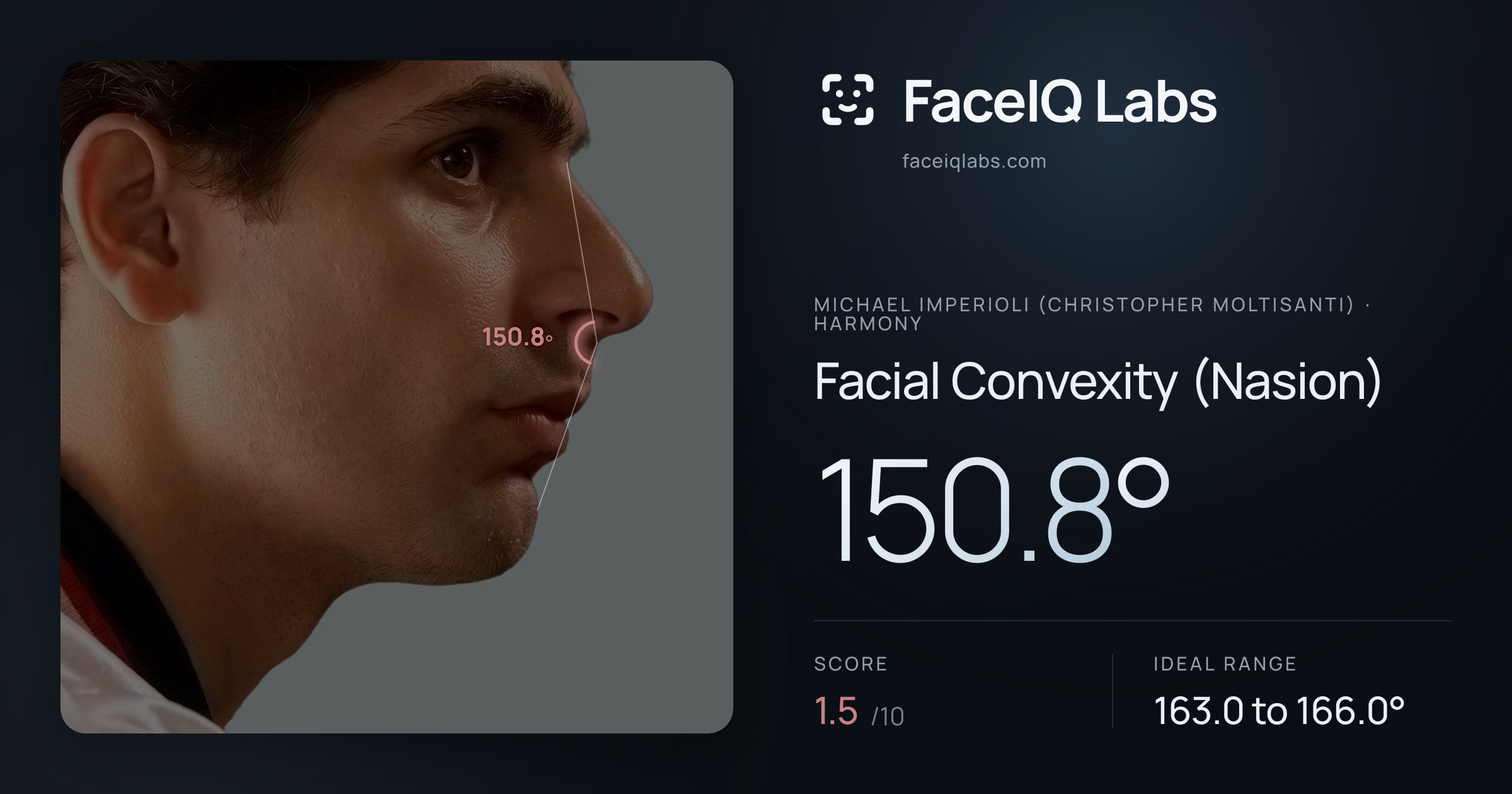 Michael Imperioli (Christopher Moltisanti) Facial Convexity (Nasion): 150.8°, drawn on the photo