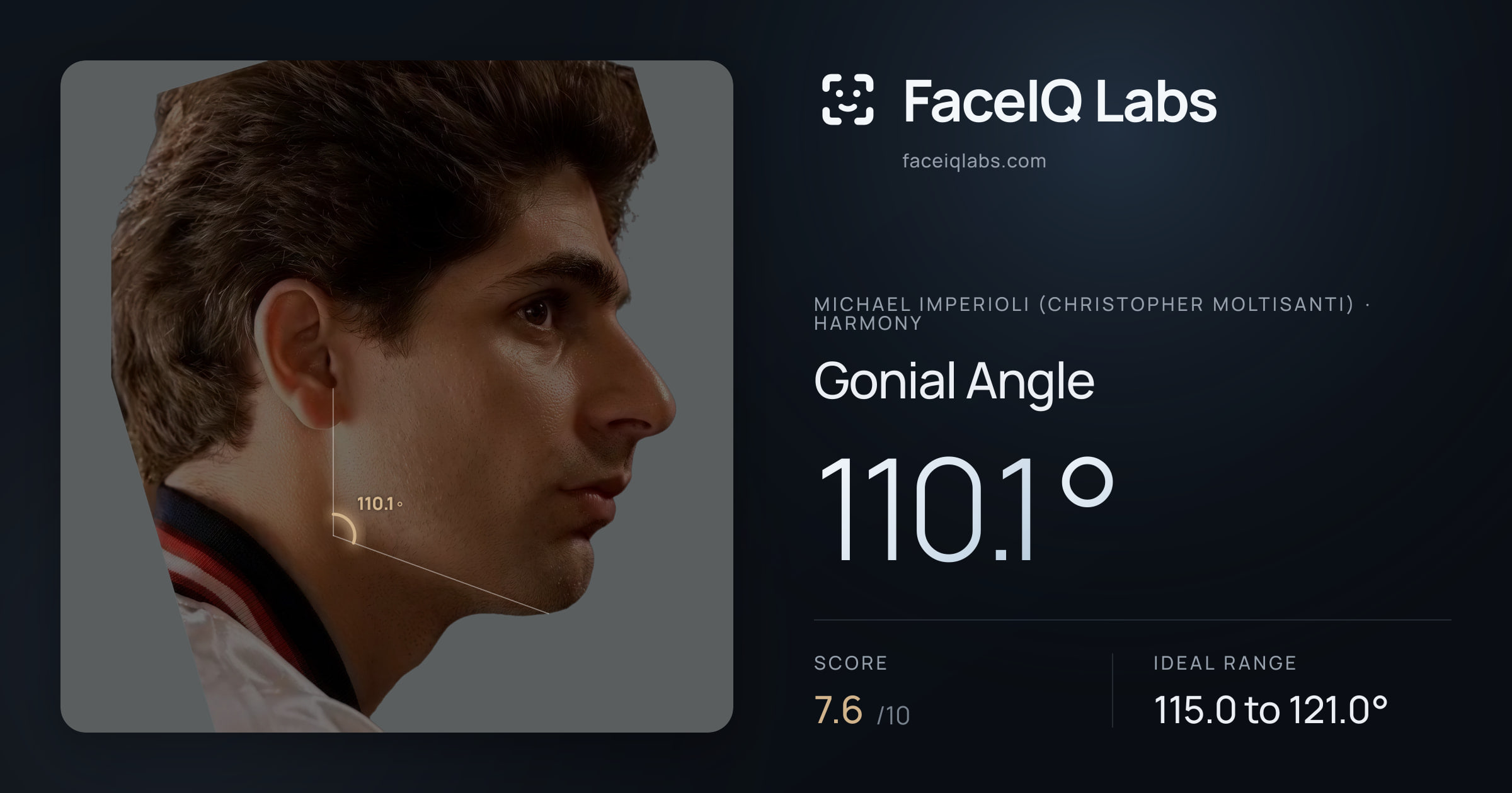 Michael Imperioli (Christopher Moltisanti) Gonial Angle: 115.4°, drawn on the photo