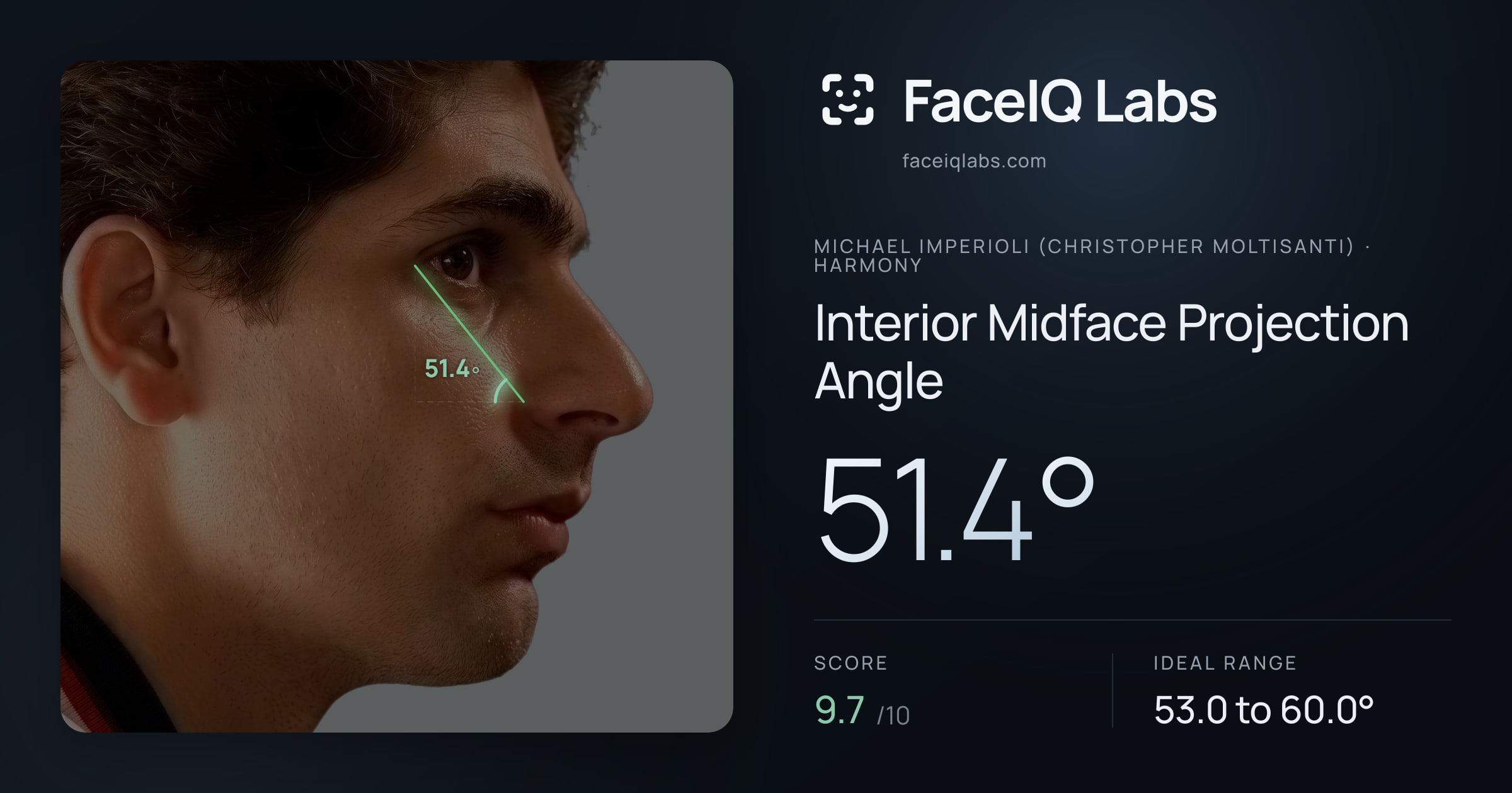 Michael Imperioli (Christopher Moltisanti) Interior Midface Projection Angle: 51.4°, drawn on the photo
