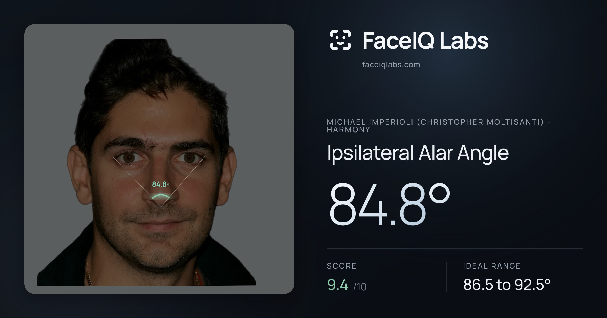 Michael Imperioli (Christopher Moltisanti) Ipsilateral Alar Angle: 84.8°, drawn on the photo
