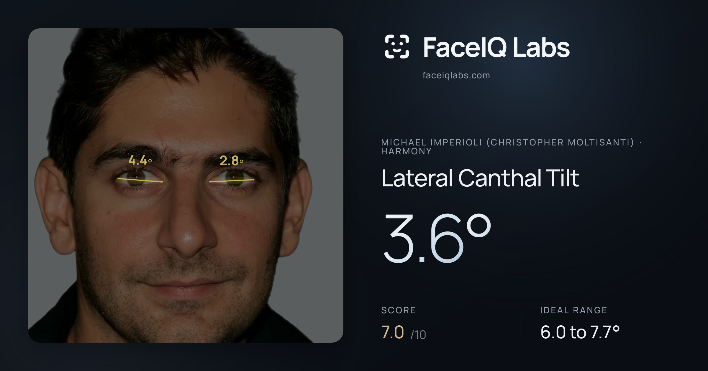 Michael Imperioli (Christopher Moltisanti) Lateral Canthal Tilt: 3.6°, drawn on the photo
