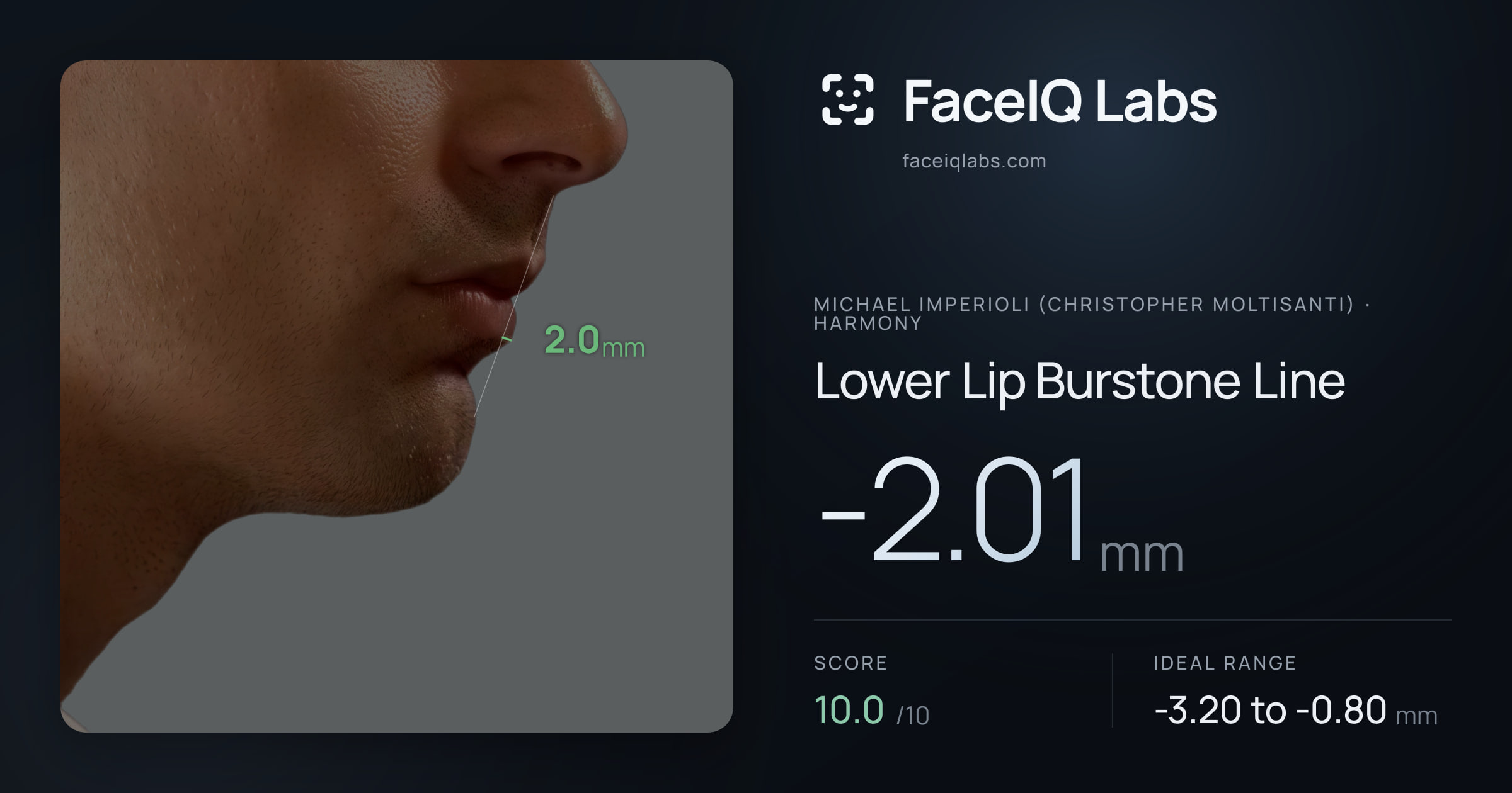 Michael Imperioli (Christopher Moltisanti) Lower Lip Burstone Line: -2.01mm, drawn on the photo
