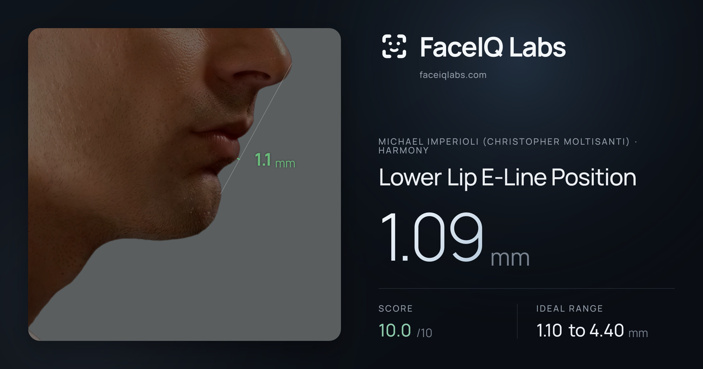 Michael Imperioli (Christopher Moltisanti) Lower Lip E-Line Position: 1.09mm, drawn on the photo