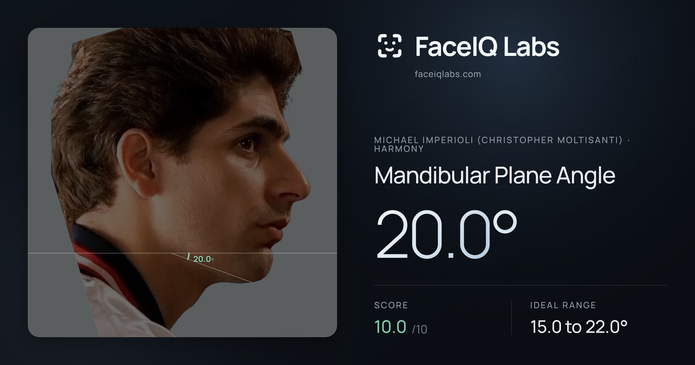 Michael Imperioli (Christopher Moltisanti) Mandibular Plane Angle: 20.0°, drawn on the photo