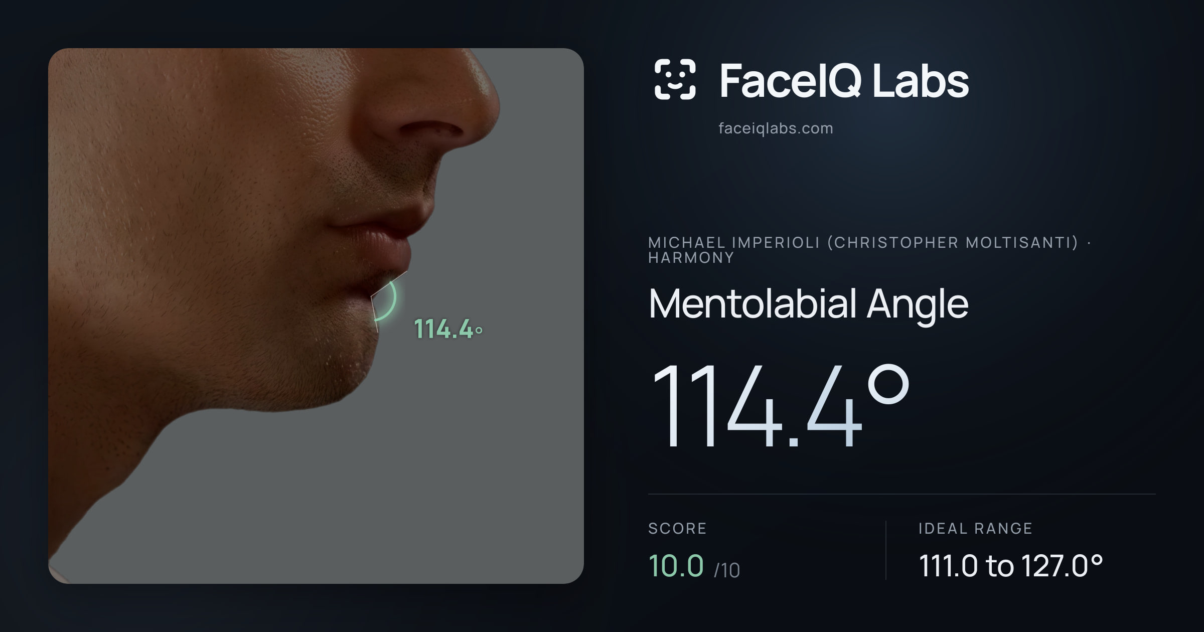 Michael Imperioli (Christopher Moltisanti) Mentolabial Angle: 114.4°, drawn on the photo