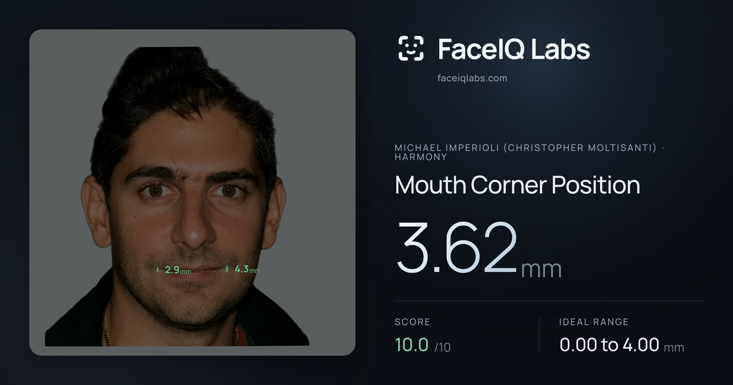 Michael Imperioli (Christopher Moltisanti) Mouth Corner Position: 3.62mm, drawn on the photo