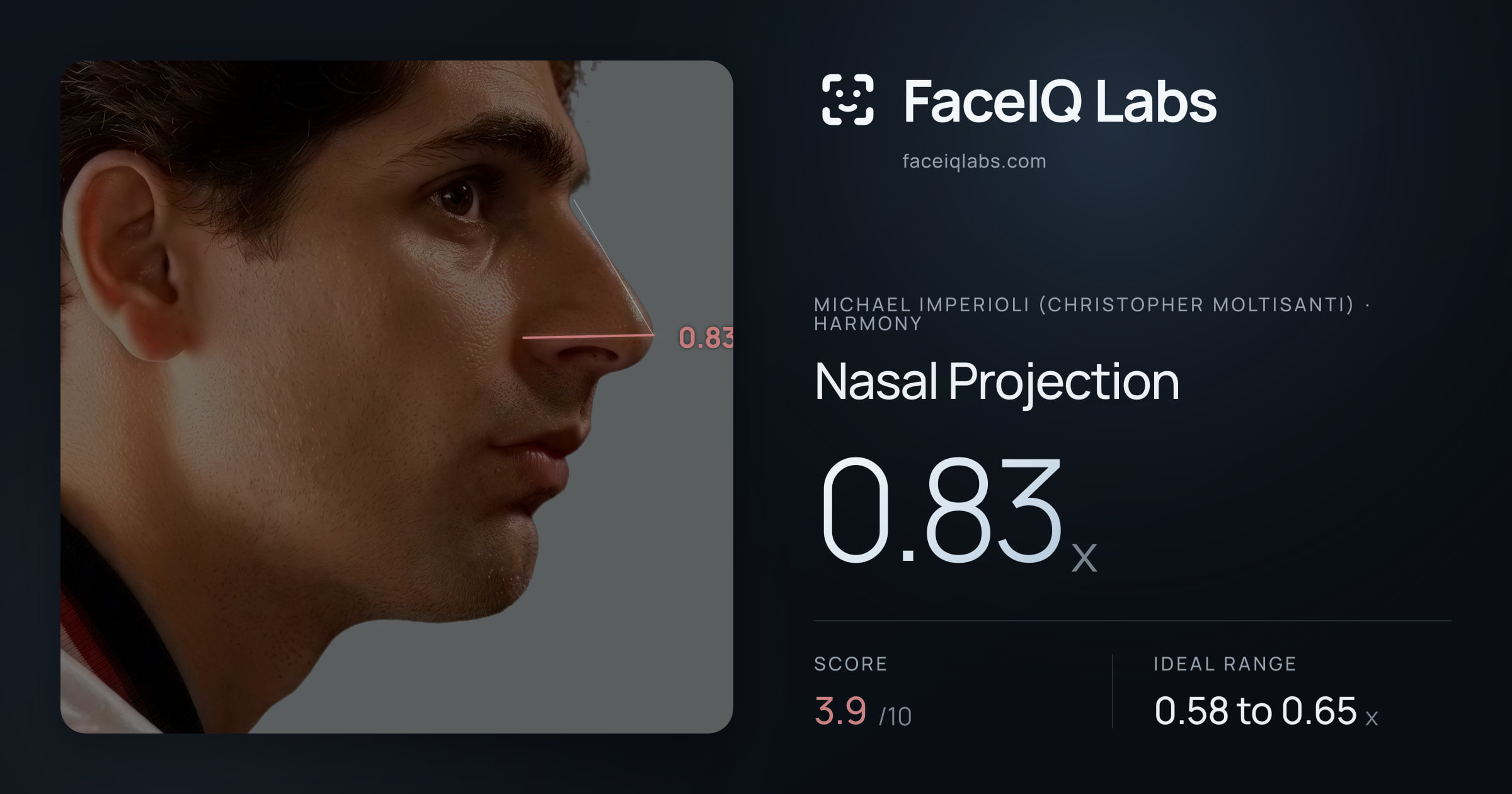 Michael Imperioli (Christopher Moltisanti) Nasal Projection: 0.83x, drawn on the photo