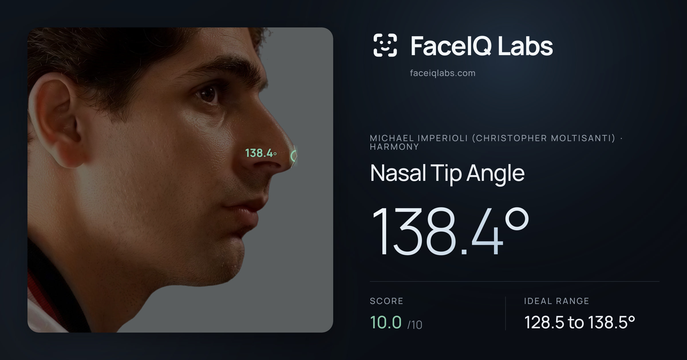 Michael Imperioli (Christopher Moltisanti) Nasal Tip Angle: 138.4°, drawn on the photo