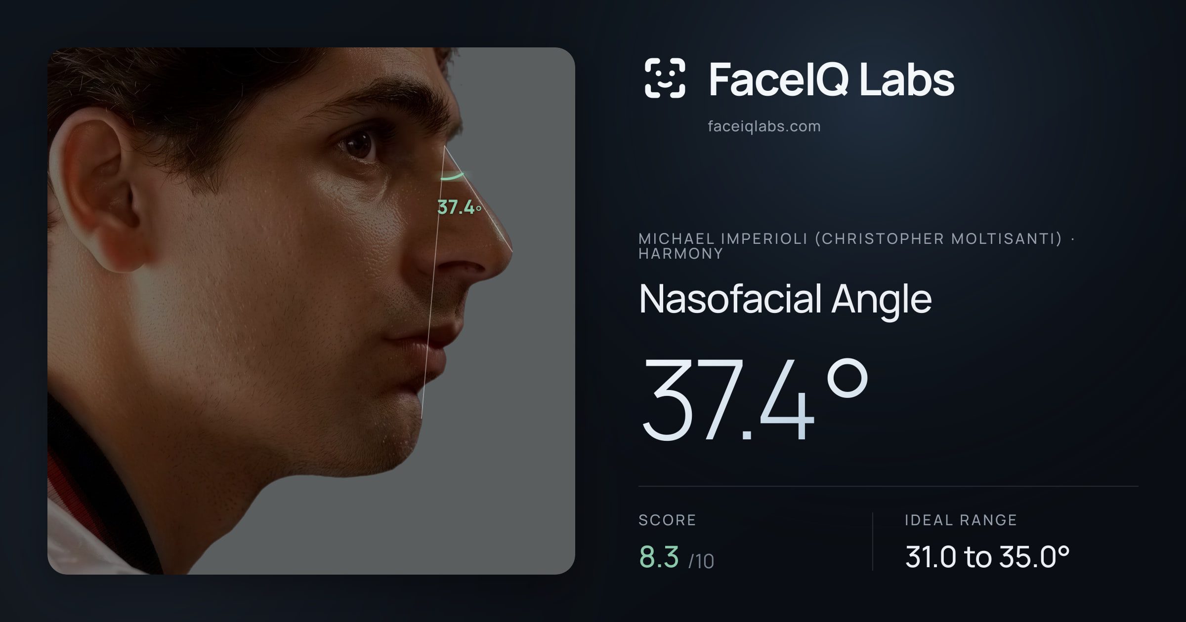 Michael Imperioli (Christopher Moltisanti) Nasofacial Angle: 37.4°, drawn on the photo