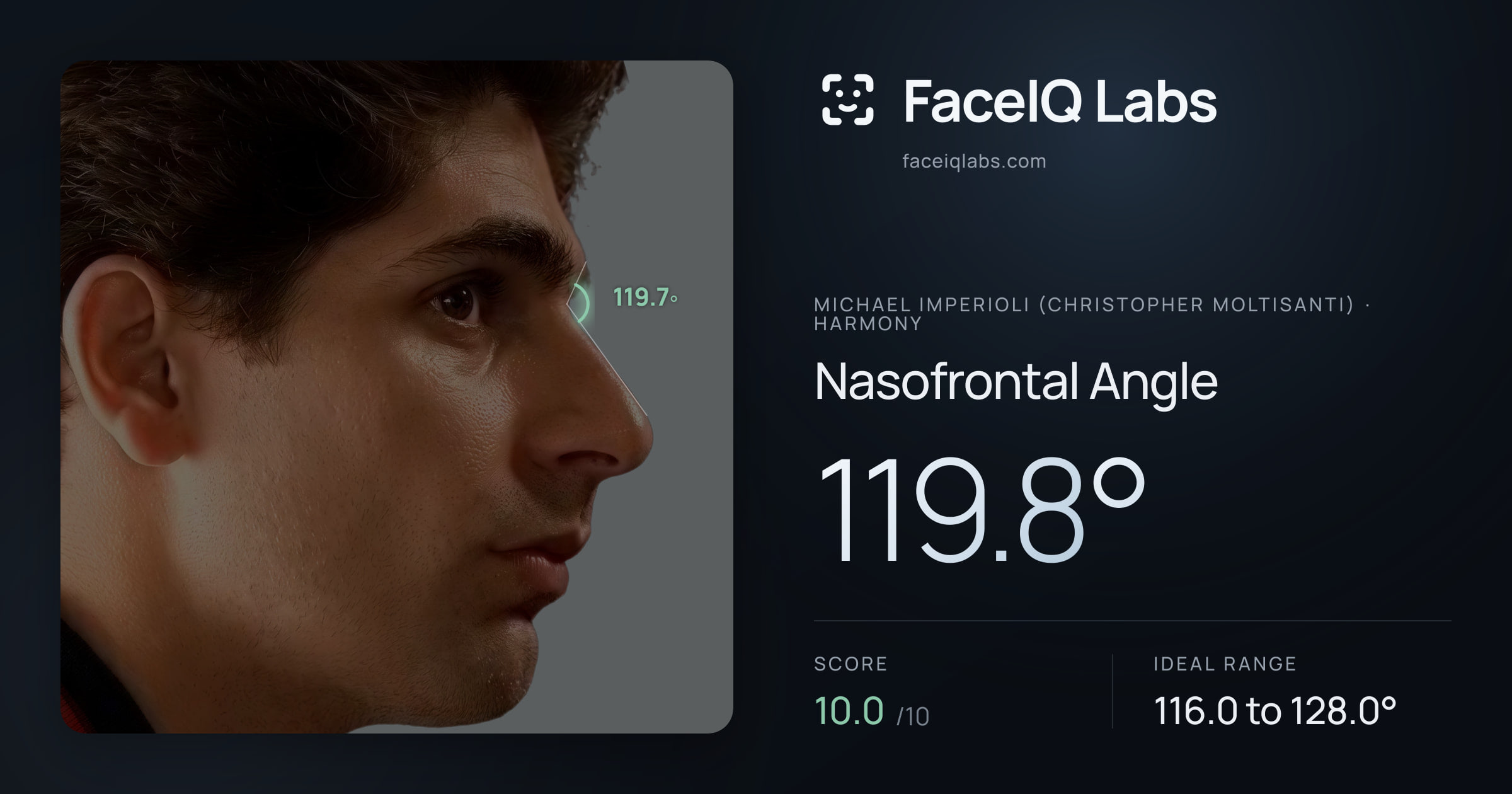Michael Imperioli (Christopher Moltisanti) Nasofrontal Angle: 119.8°, drawn on the photo