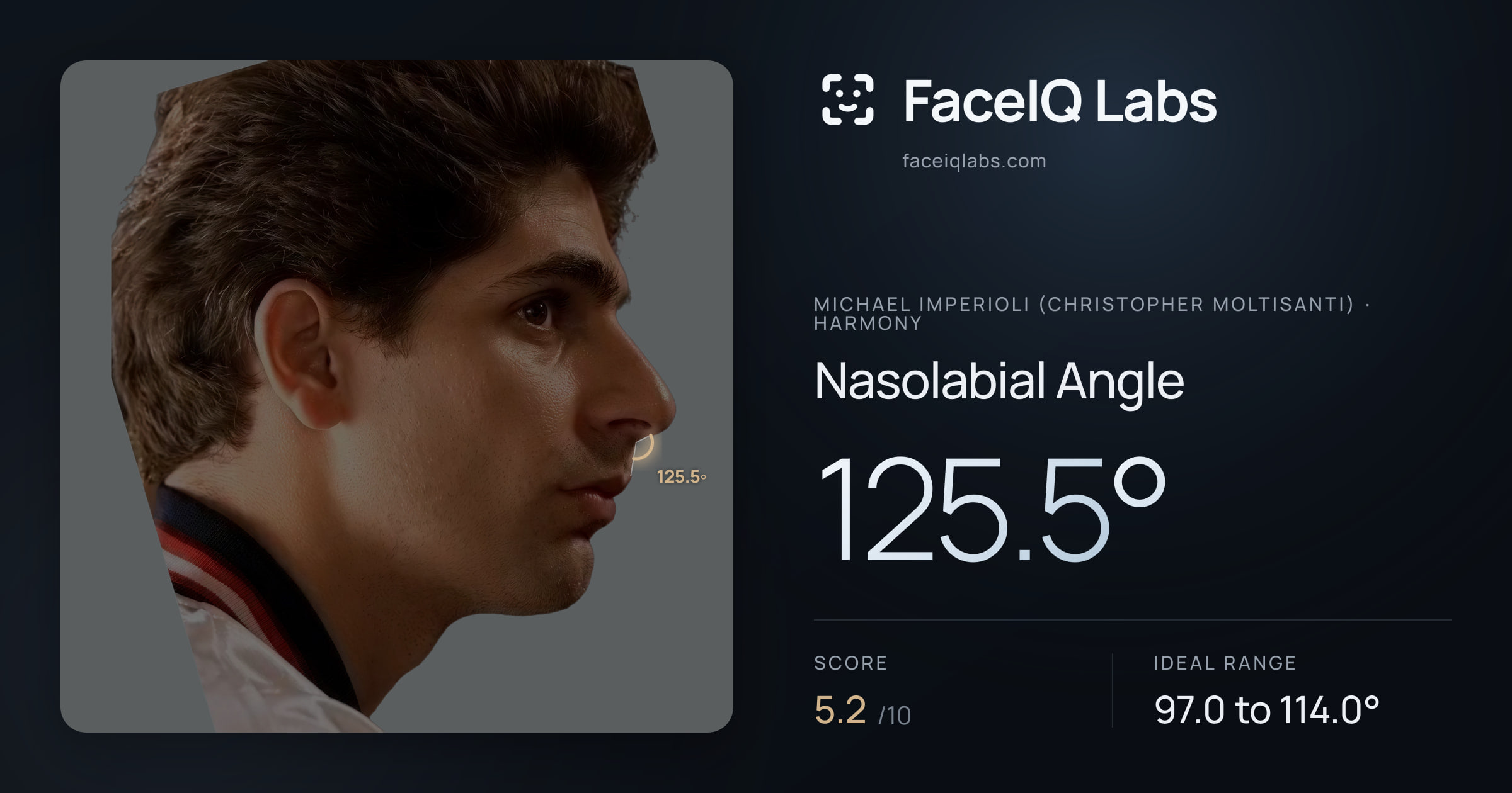 Michael Imperioli (Christopher Moltisanti) Nasolabial Angle: 125.5°, drawn on the photo