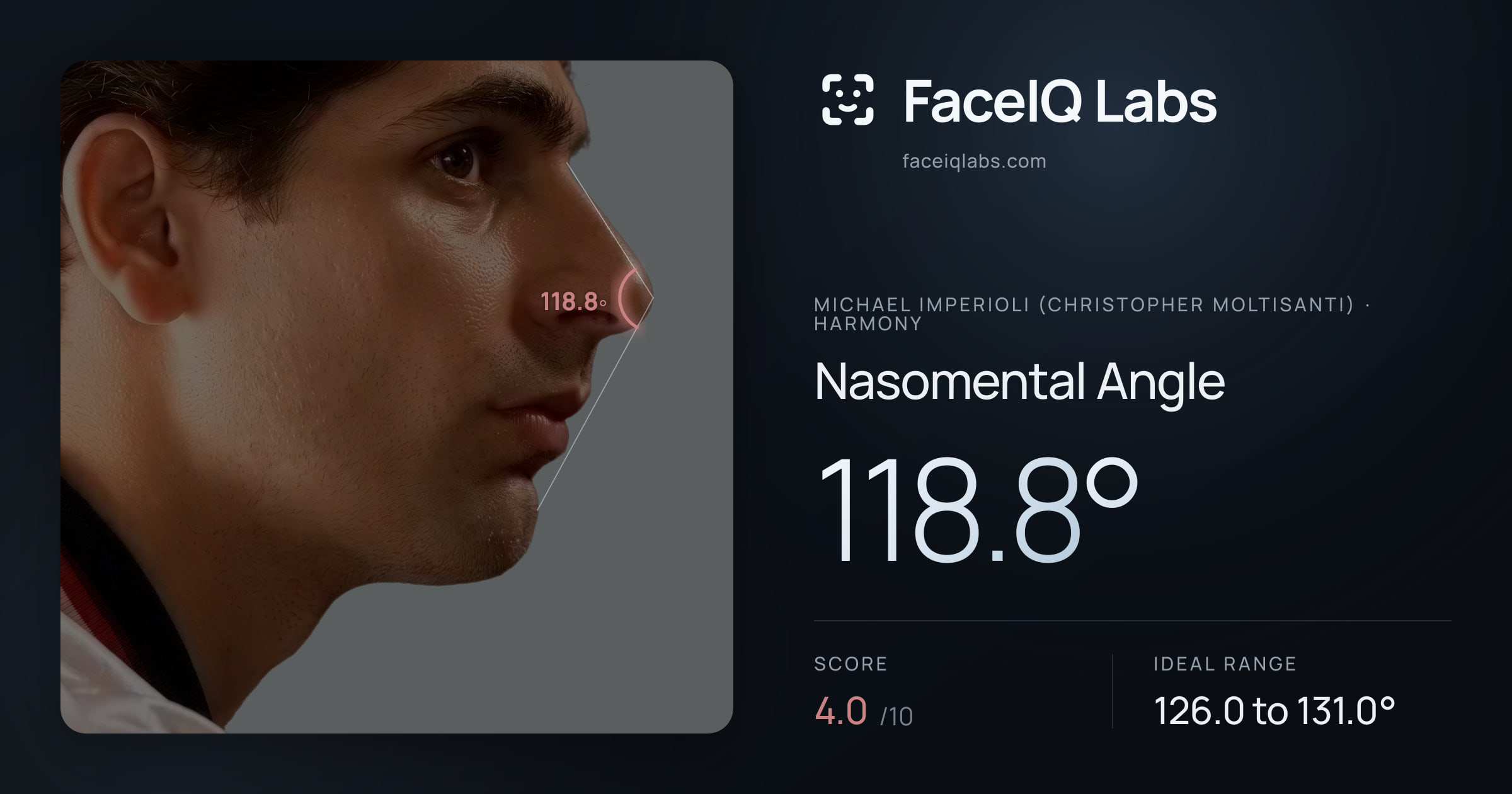 Michael Imperioli (Christopher Moltisanti) Nasomental Angle: 118.8°, drawn on the photo