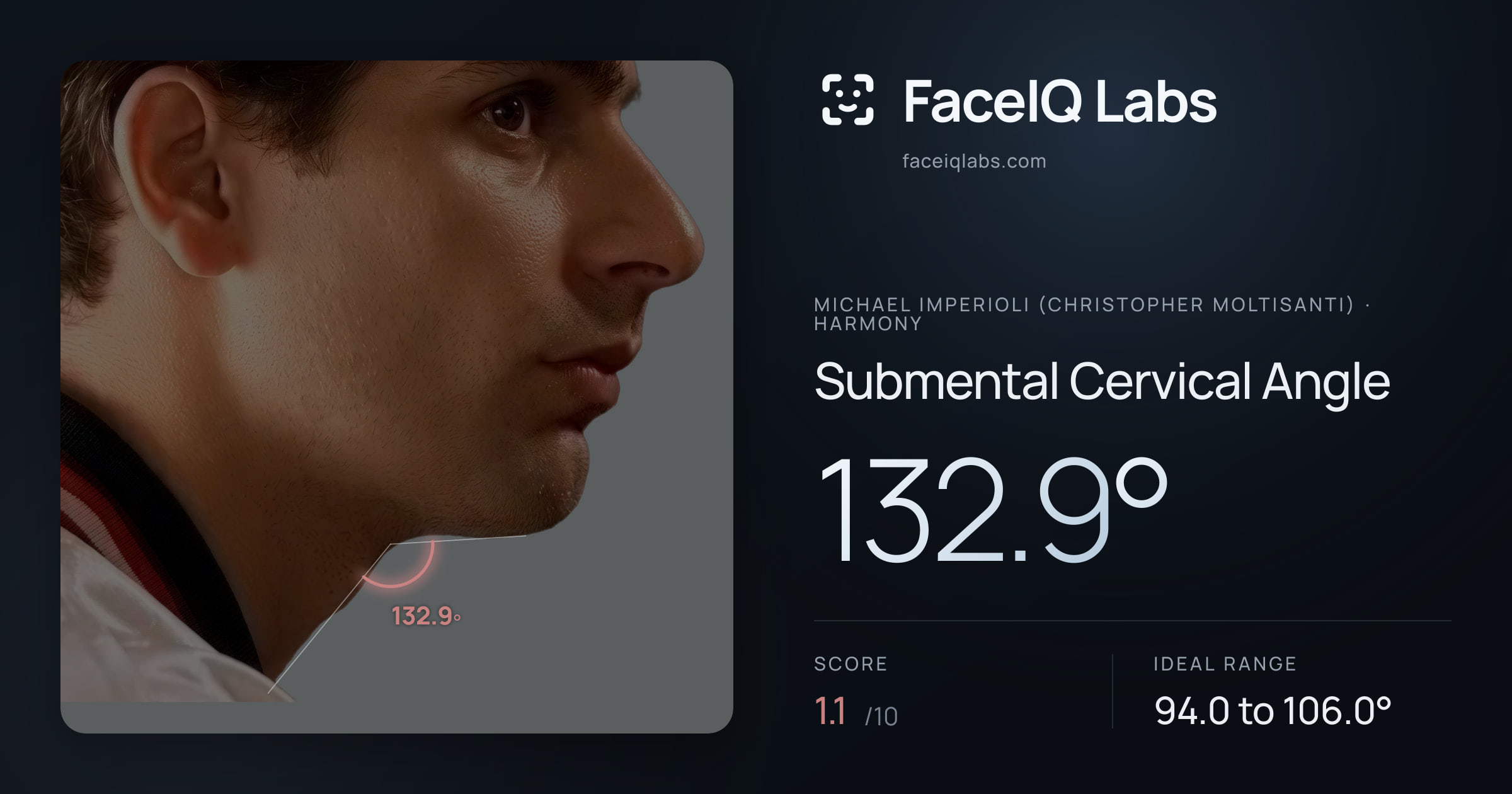 Michael Imperioli (Christopher Moltisanti) Submental Cervical Angle: 132.9°, drawn on the photo