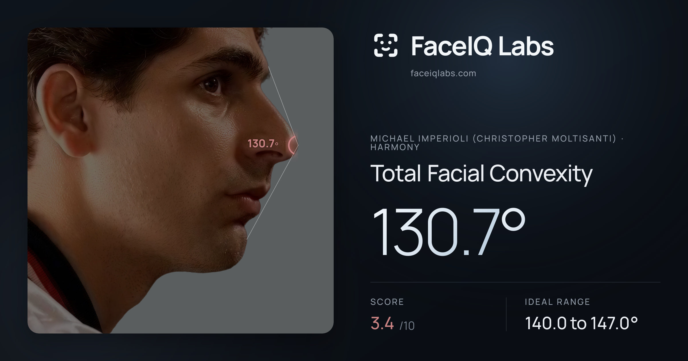 Michael Imperioli (Christopher Moltisanti) Total Facial Convexity: 130.7°, drawn on the photo