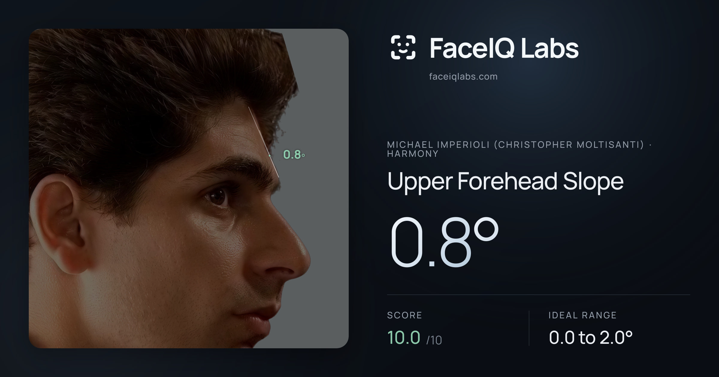 Michael Imperioli (Christopher Moltisanti) Upper Forehead Slope: 0.8°, drawn on the photo