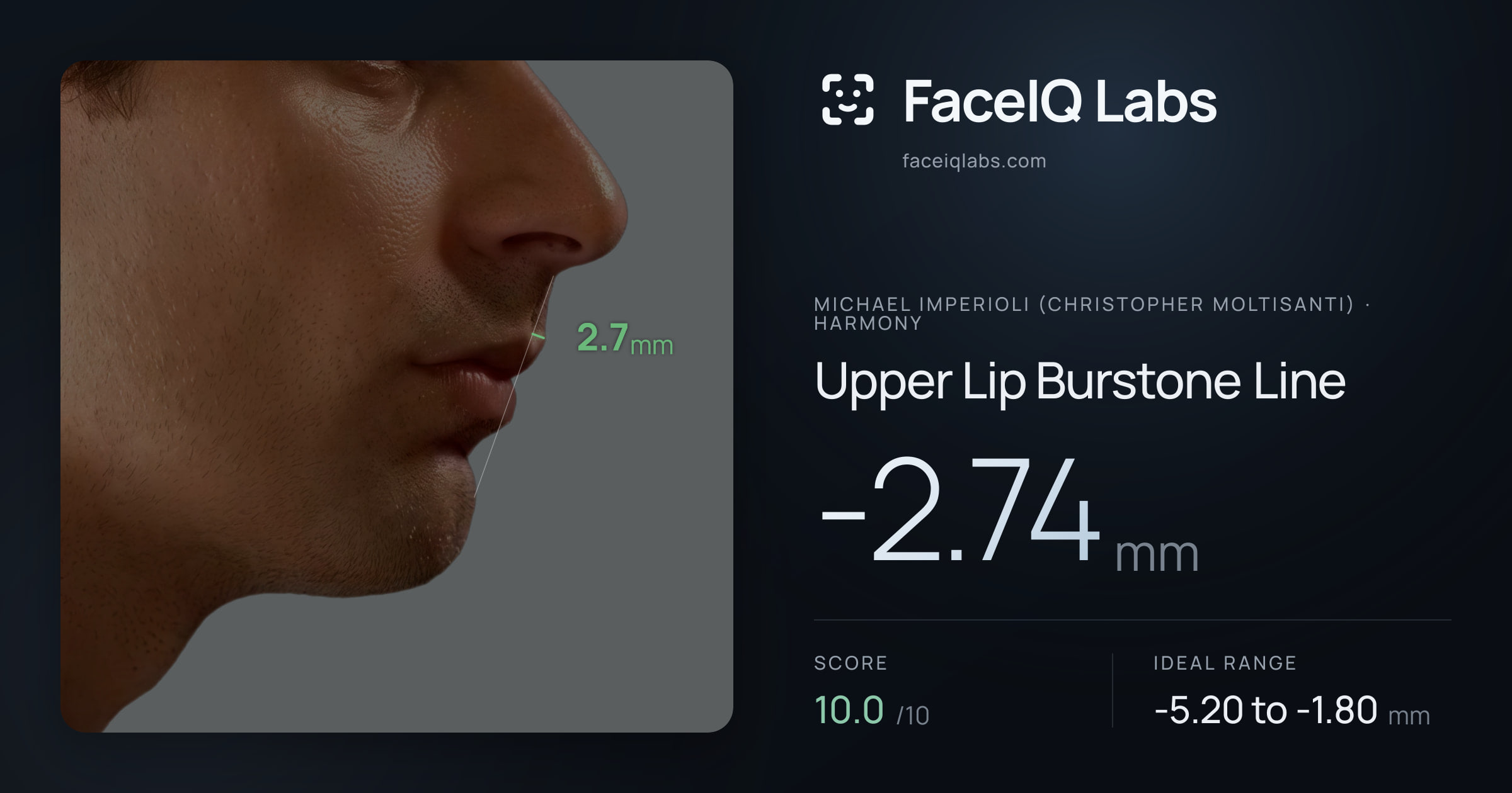 Michael Imperioli (Christopher Moltisanti) Upper Lip Burstone Line: -2.74mm, drawn on the photo
