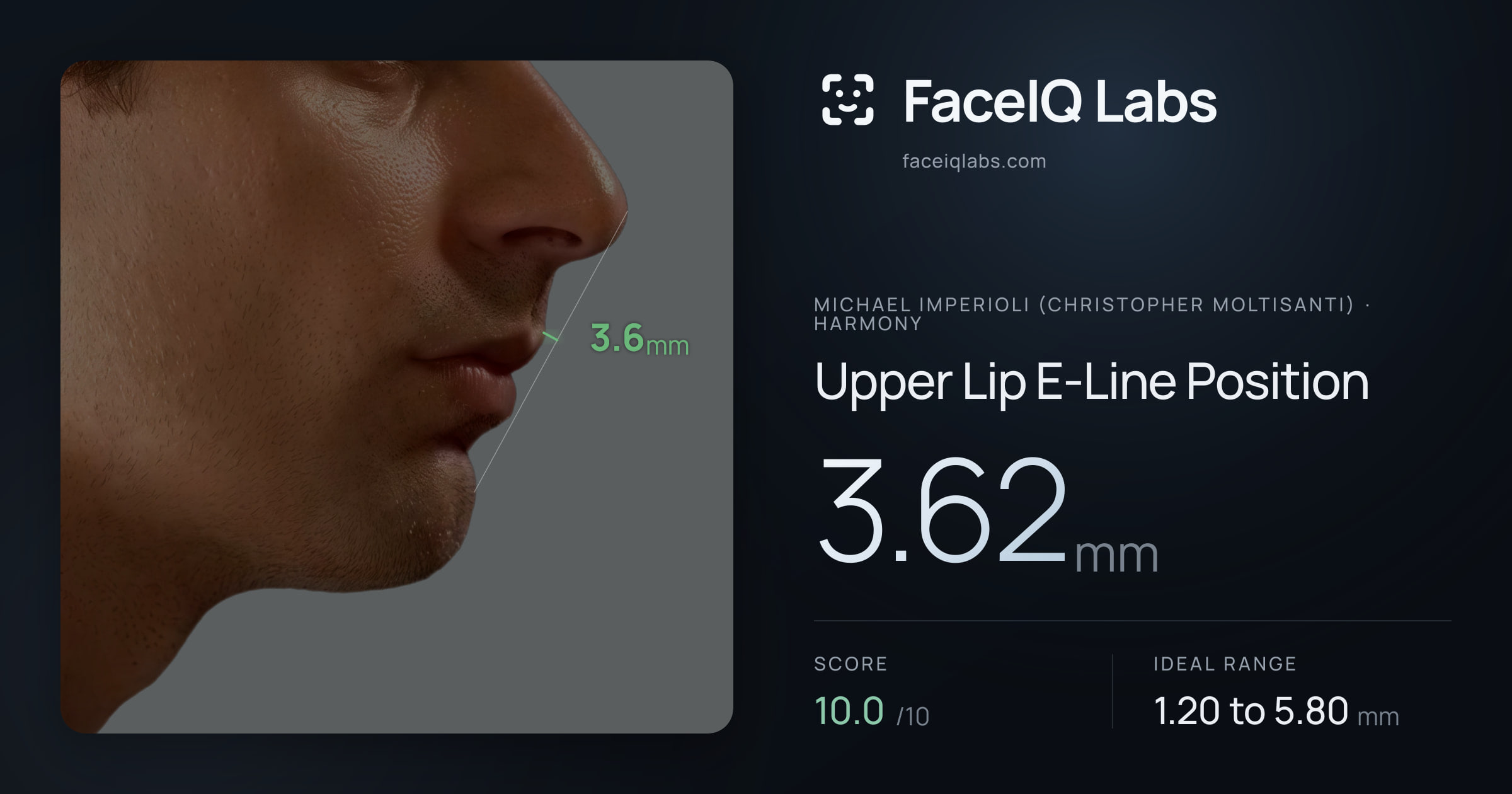 Michael Imperioli (Christopher Moltisanti) Upper Lip E-Line Position: 3.62mm, drawn on the photo