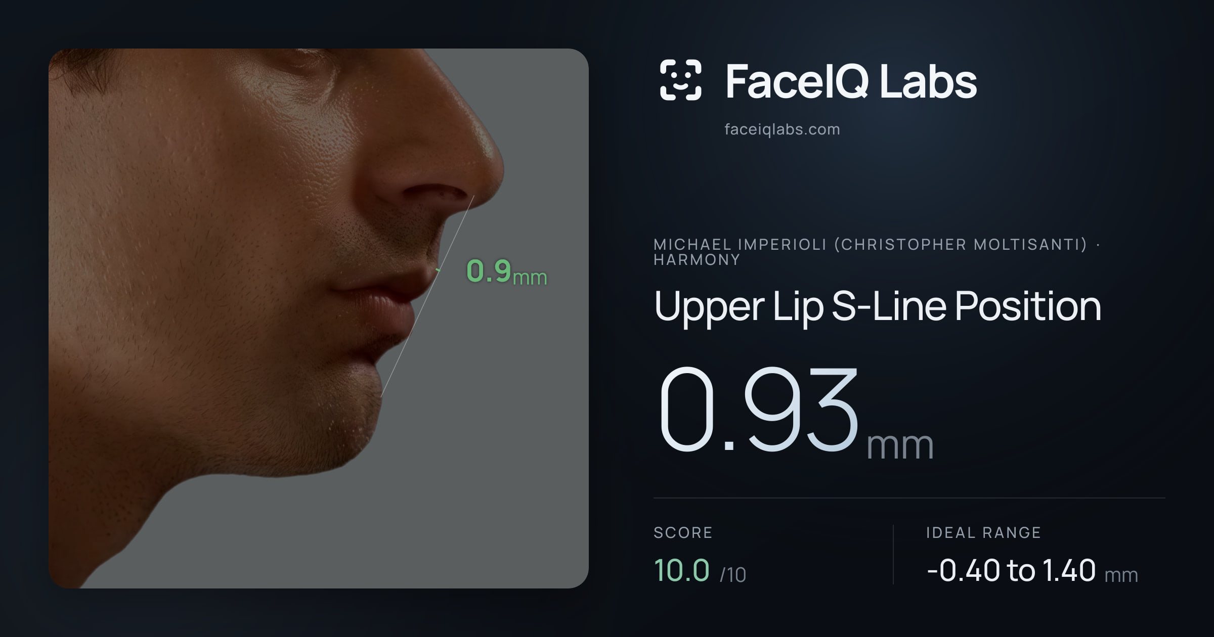 Michael Imperioli (Christopher Moltisanti) Upper Lip S-Line Position: 0.93mm, drawn on the photo