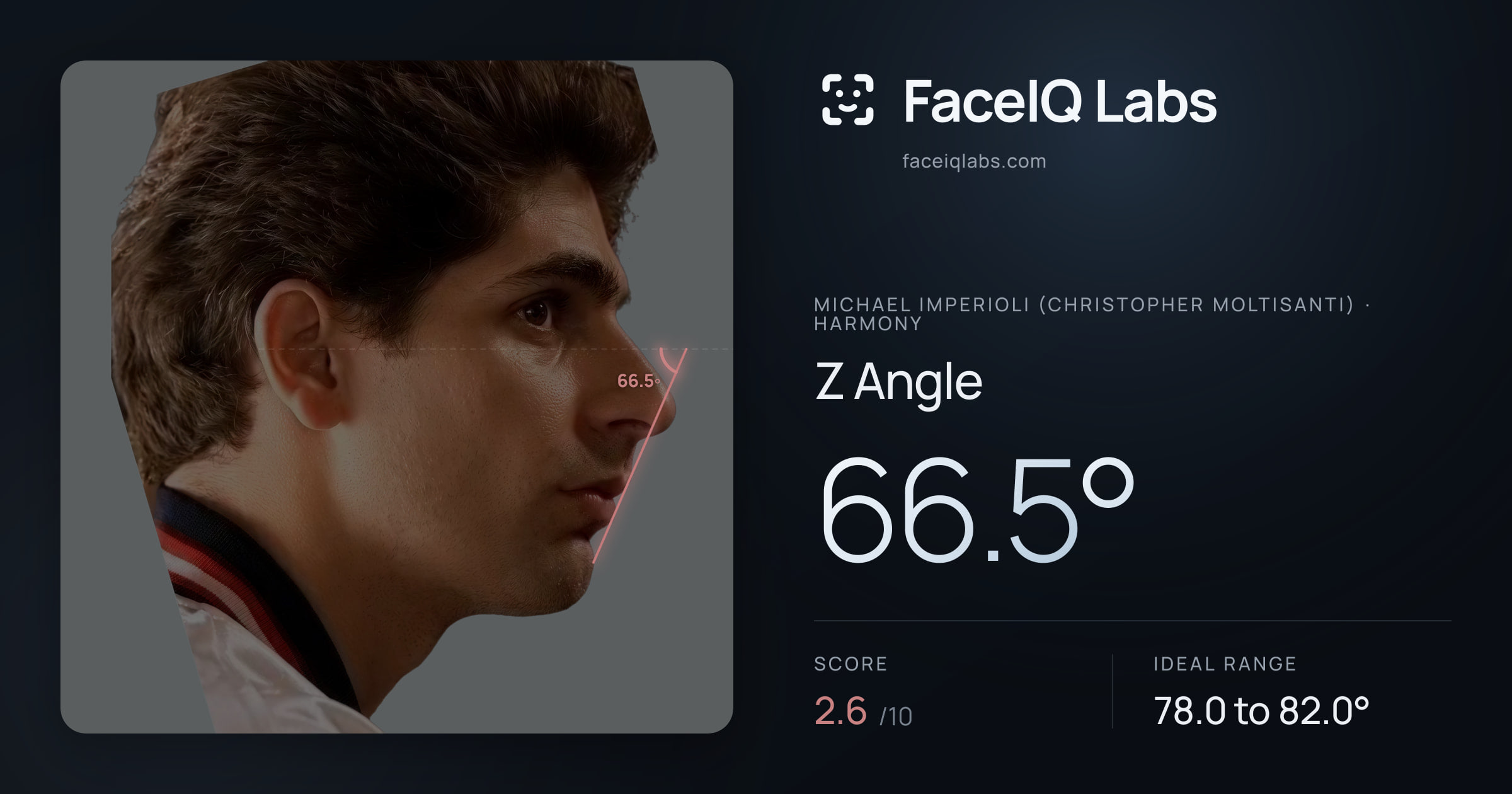 Michael Imperioli (Christopher Moltisanti) Z Angle: 66.5°, drawn on the photo