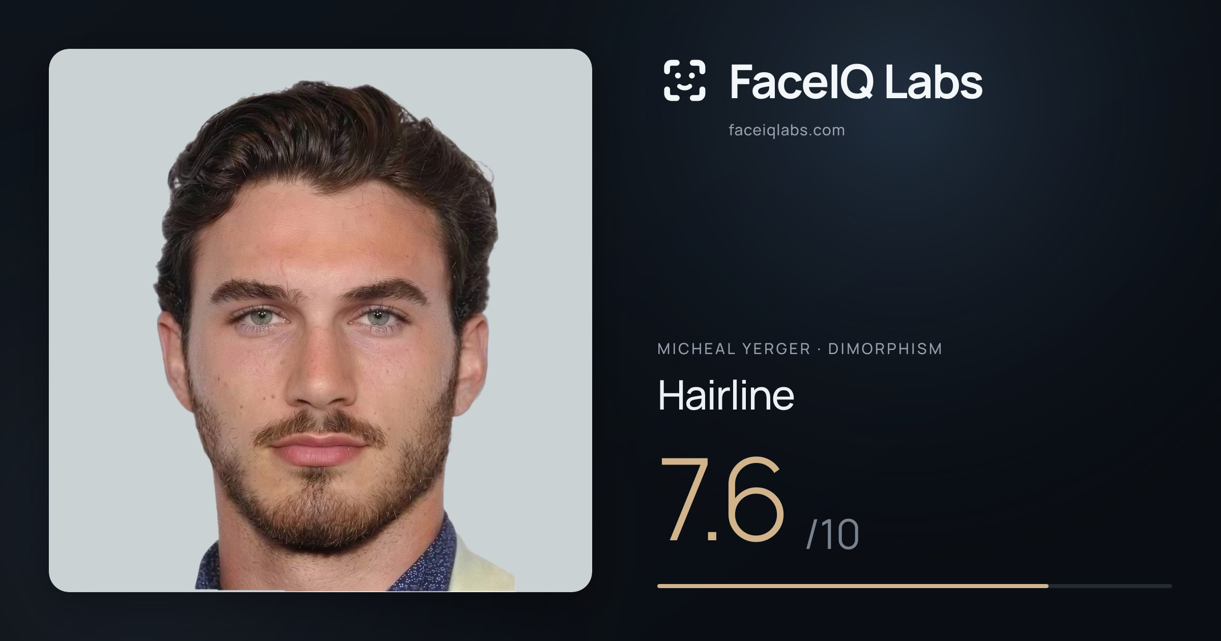 Micheal Yerger Hairline: 7.6/10, drawn on the photo