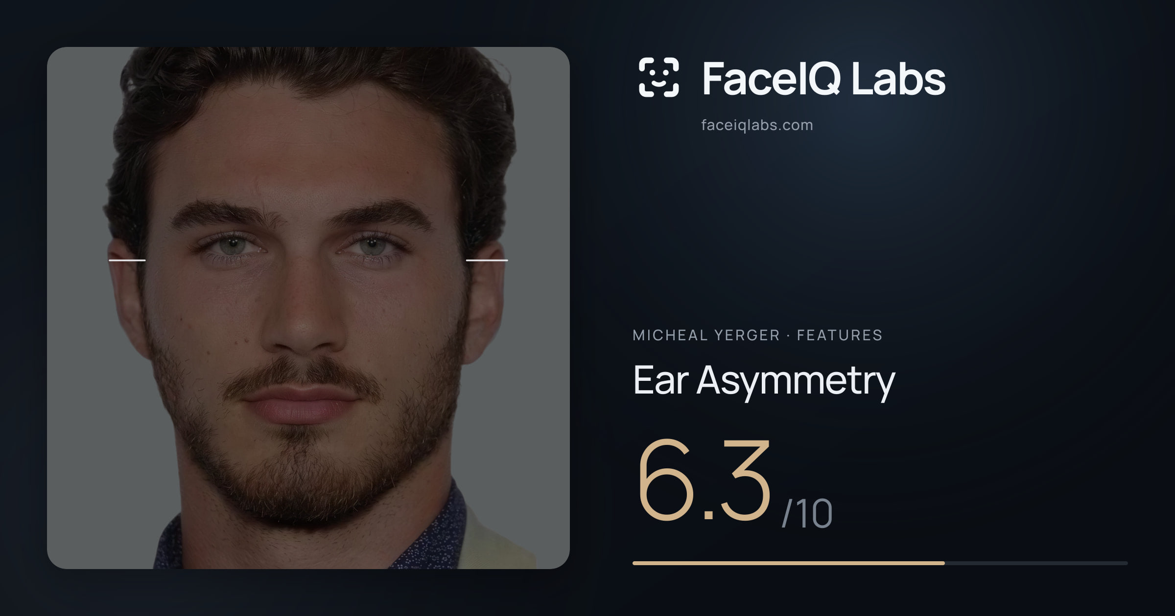 Micheal Yerger Ear Asymmetry: 6.3/10, drawn on the photo
