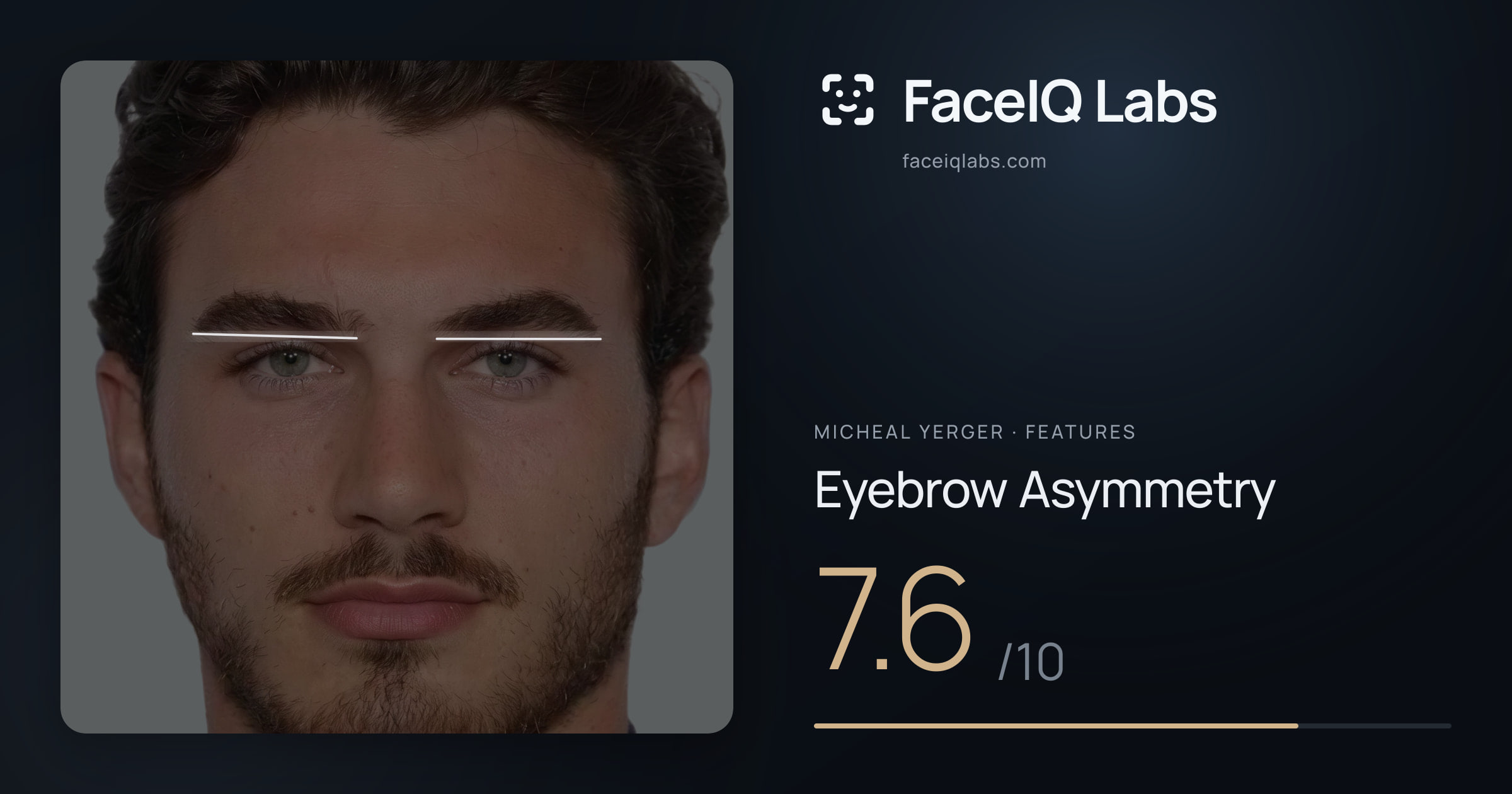 Micheal Yerger Eyebrow Asymmetry: 7.6/10, drawn on the photo