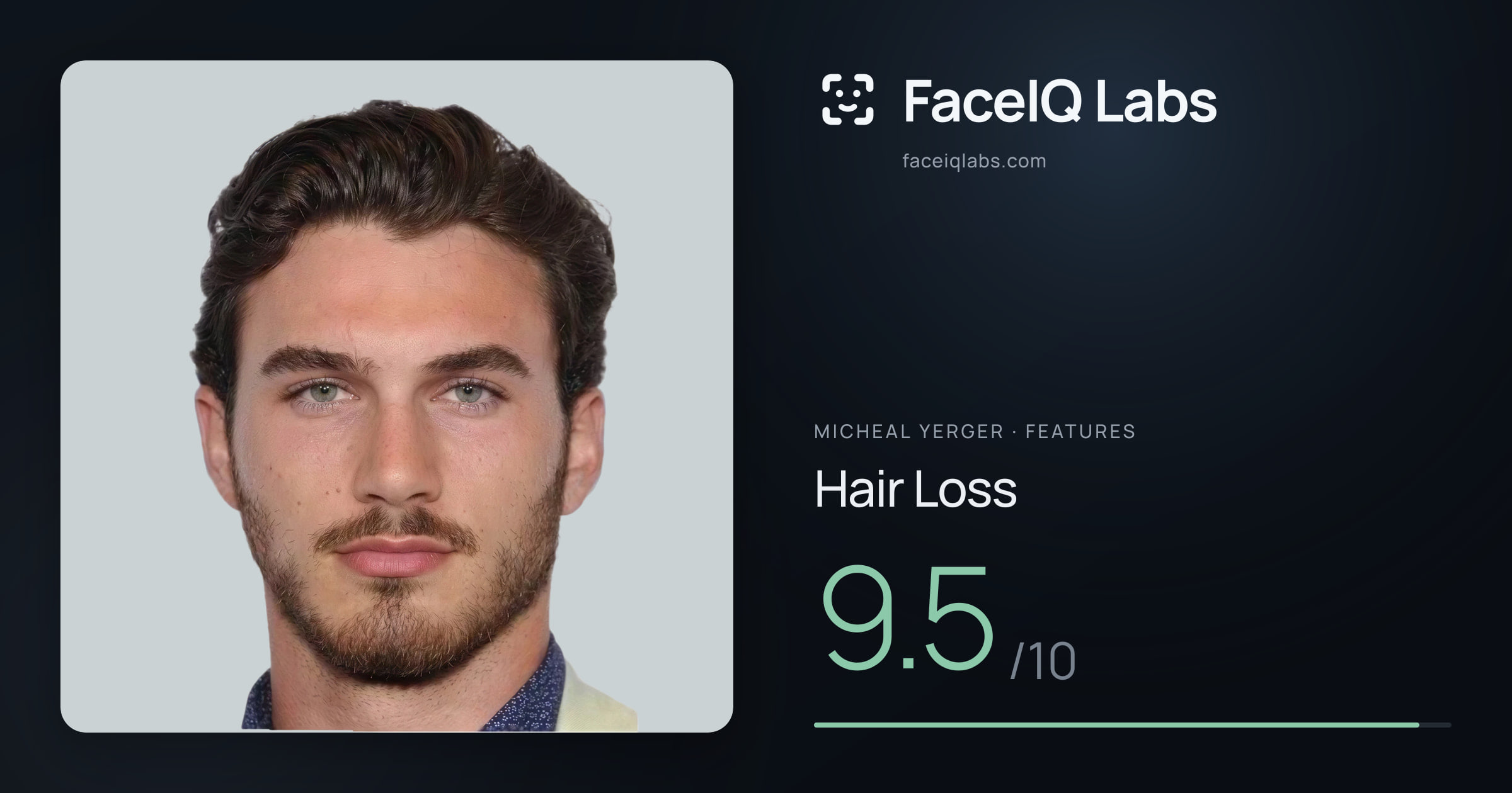 Micheal Yerger Hair Loss: 9.5/10, drawn on the photo
