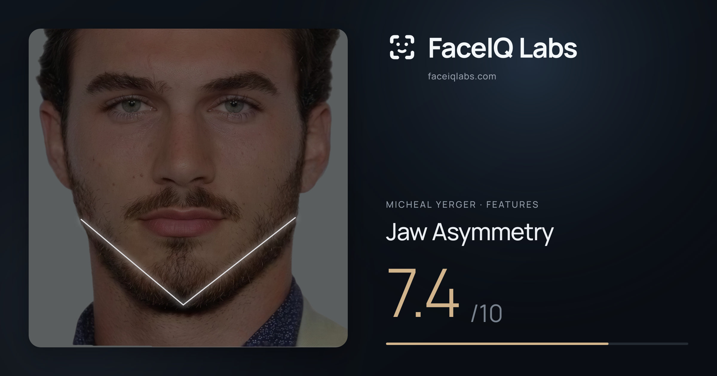 Micheal Yerger Jaw Asymmetry: 7.4/10, drawn on the photo