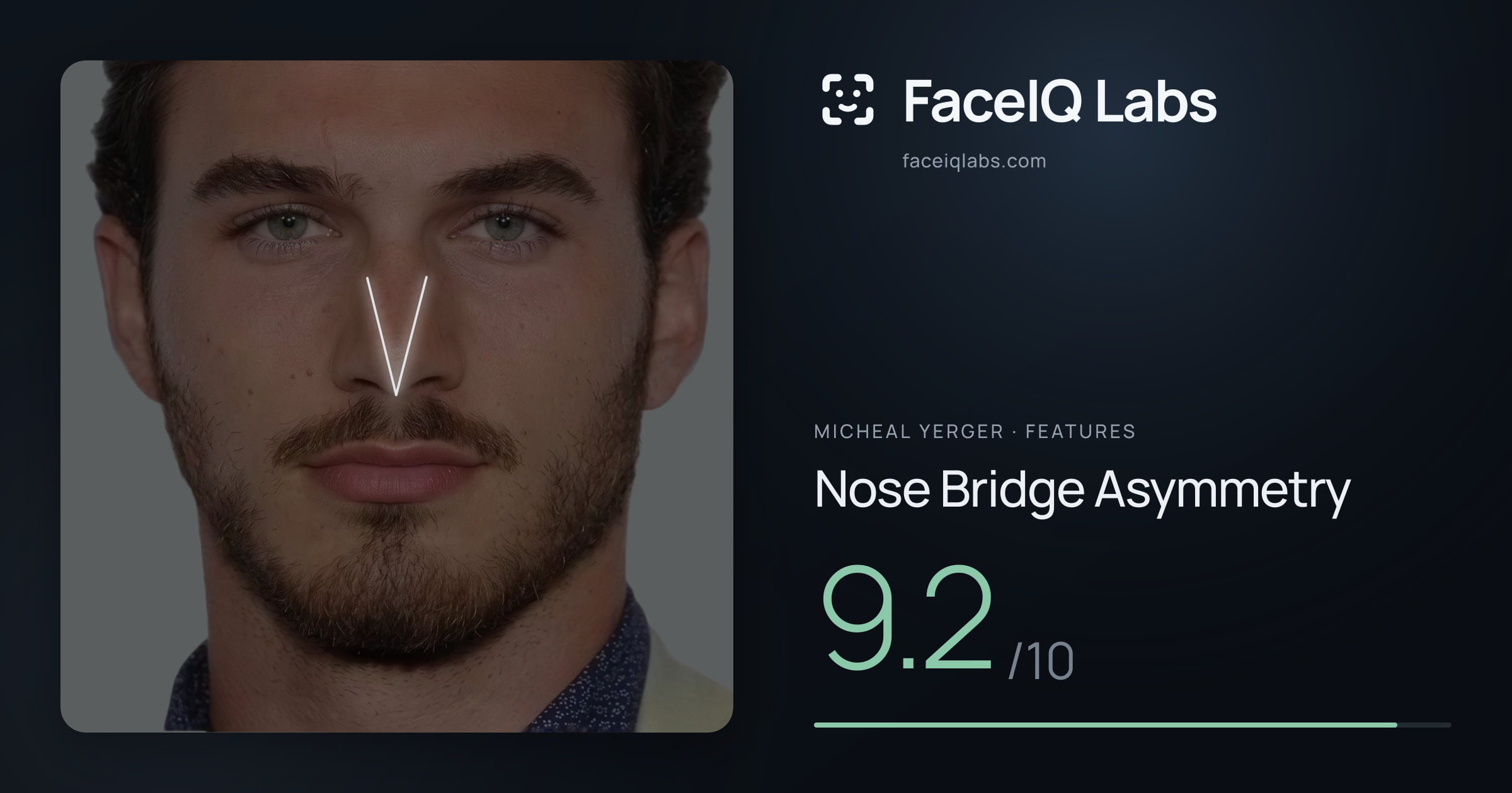 Micheal Yerger Nose Bridge Asymmetry: 9.2/10, drawn on the photo