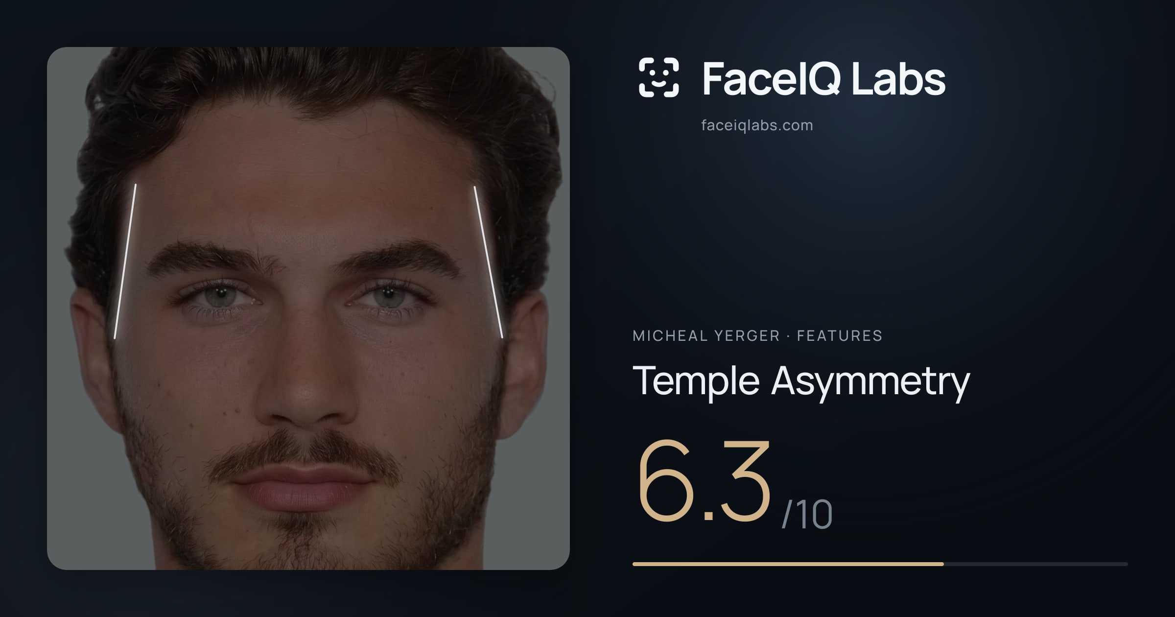 Micheal Yerger Temple Asymmetry: 6.3/10, drawn on the photo
