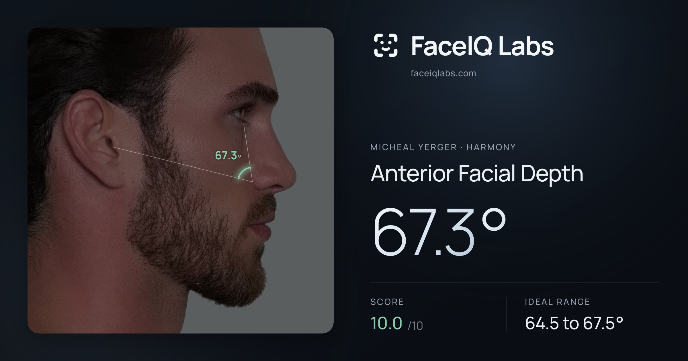 Micheal Yerger Anterior Facial Depth: 67.3°, drawn on the photo