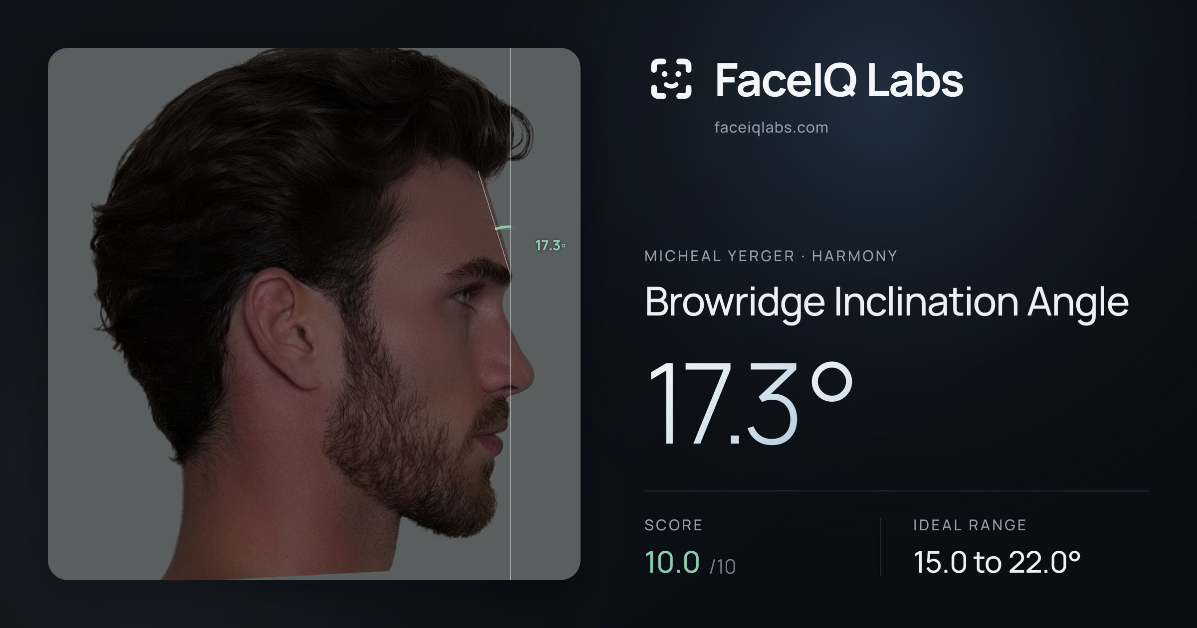 Micheal Yerger Browridge Inclination Angle: 17.3°, drawn on the photo