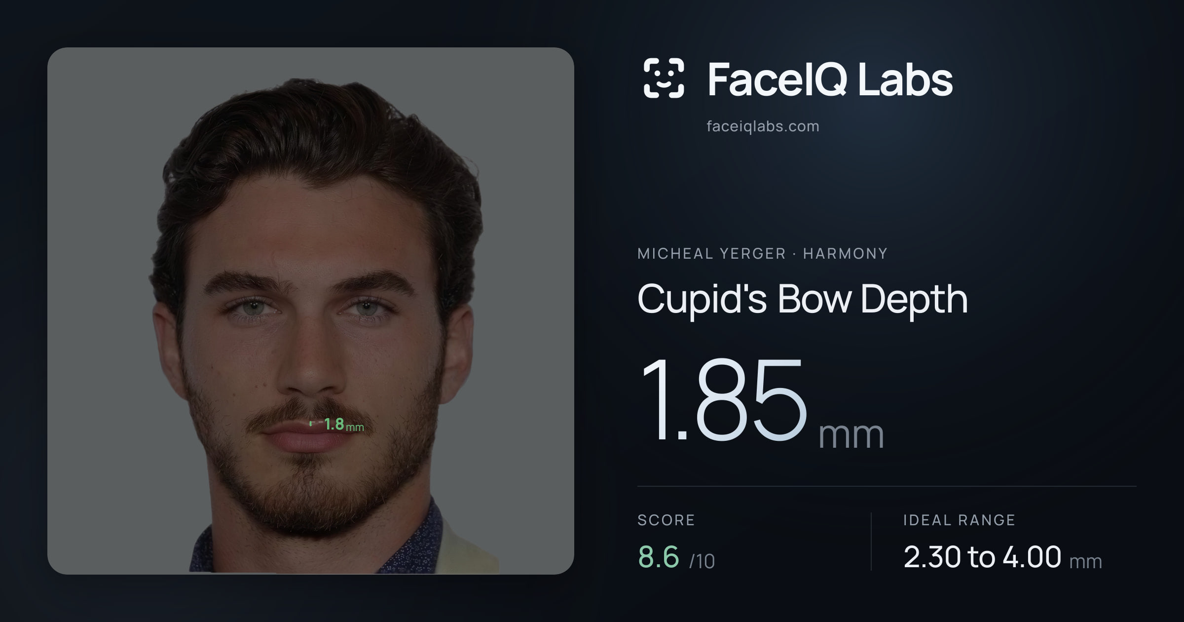 Micheal Yerger Cupid's Bow Depth: 1.85mm, drawn on the photo