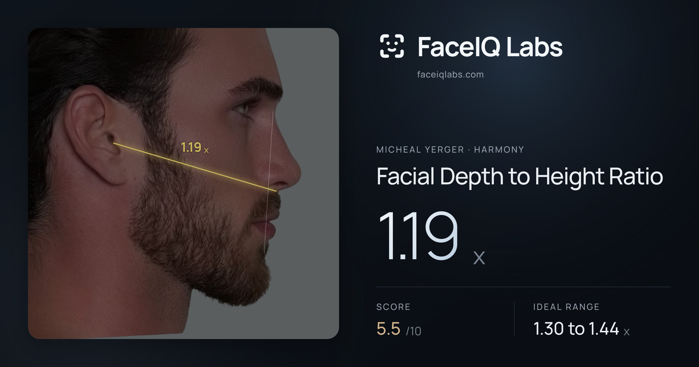 Micheal Yerger Facial Depth to Height Ratio: 1.19x, drawn on the photo