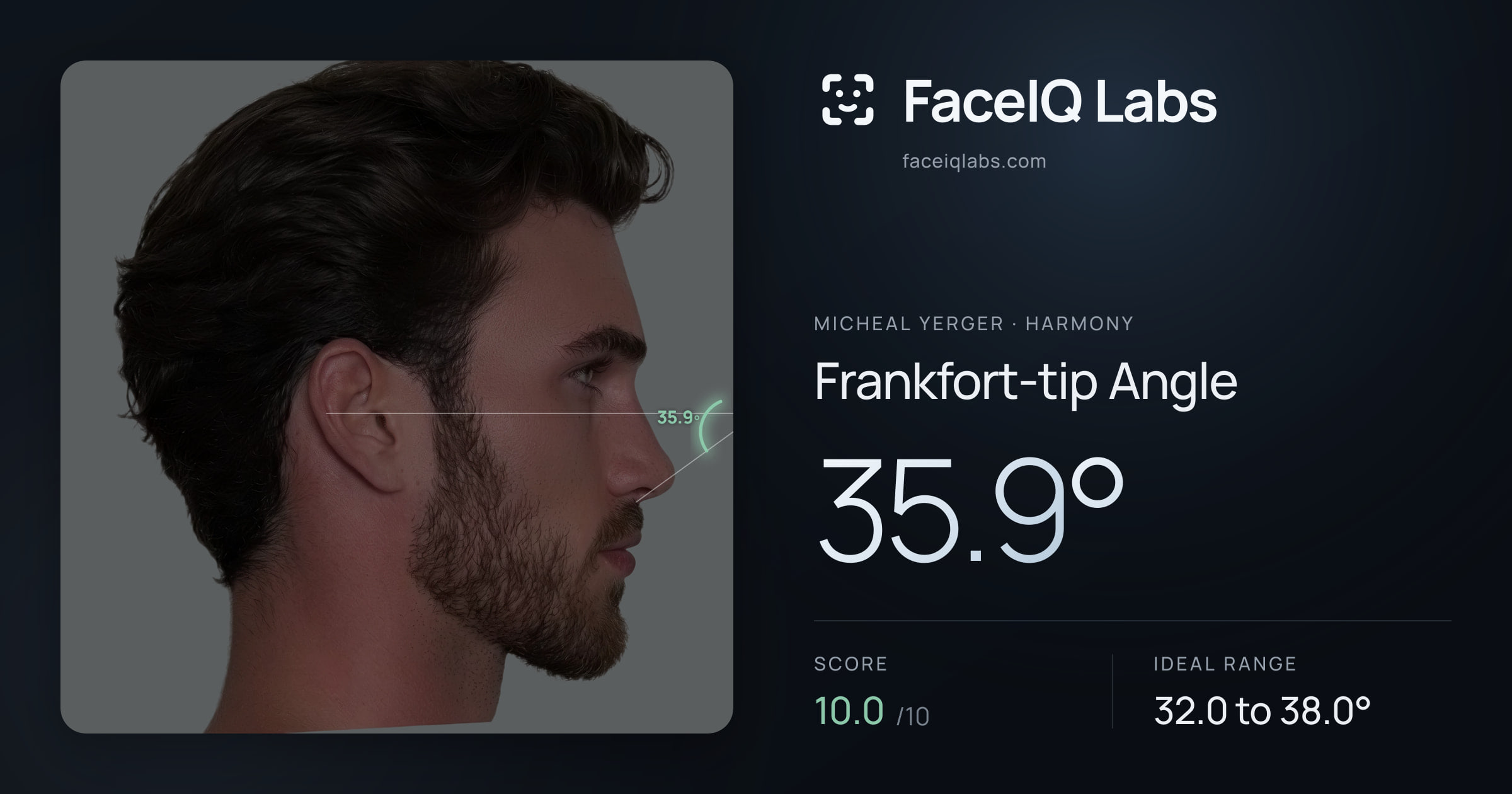 Micheal Yerger Frankfort-tip Angle: 35.9°, drawn on the photo