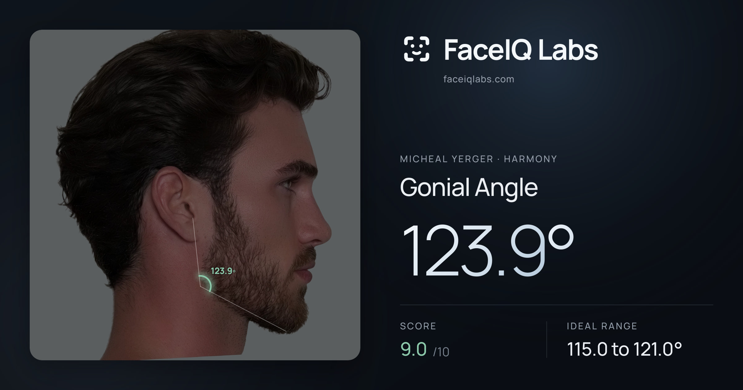 Micheal Yerger Gonial Angle: 123.9°, drawn on the photo