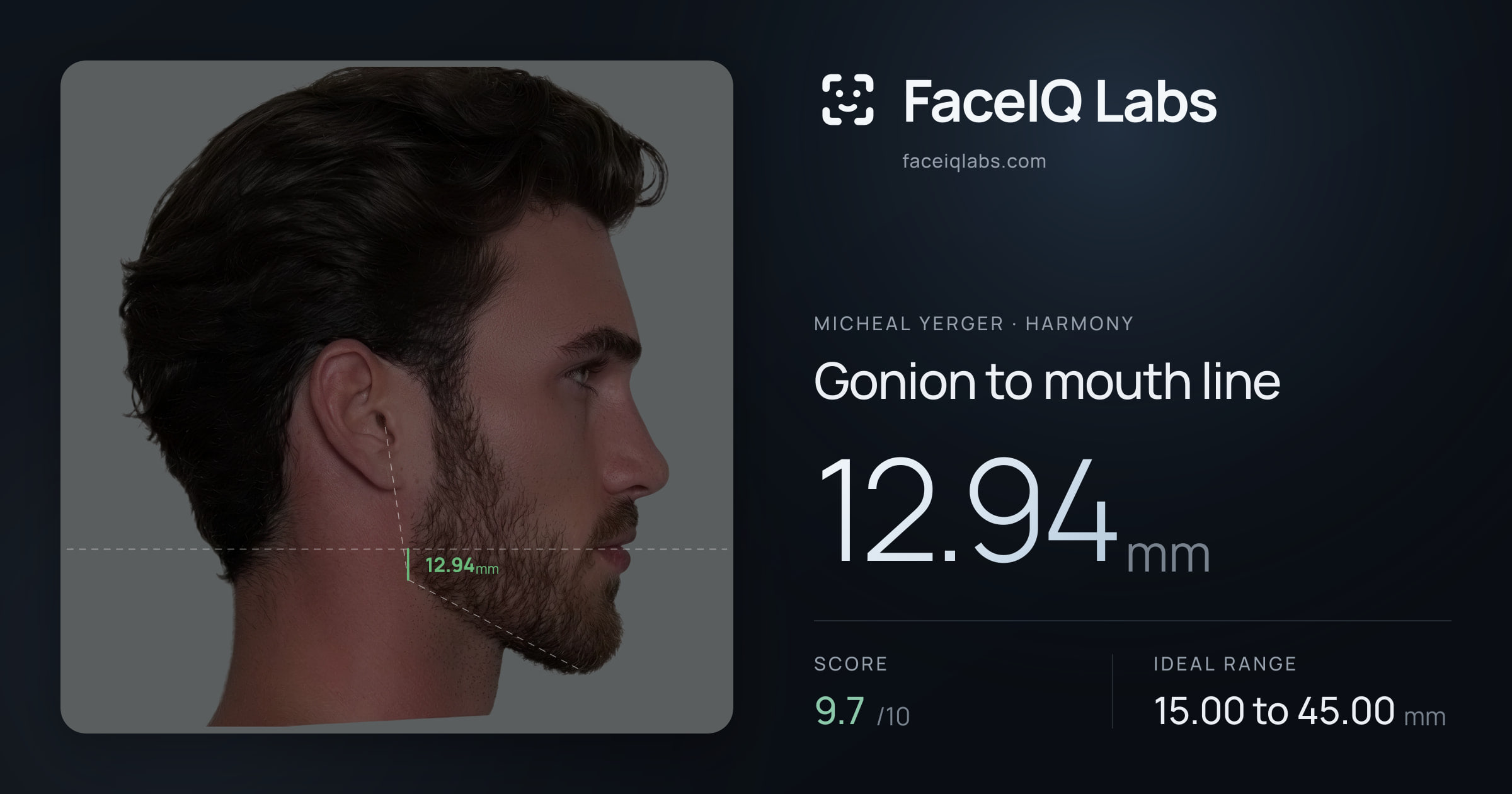 Micheal Yerger Gonion to mouth line: 12.94mm, drawn on the photo