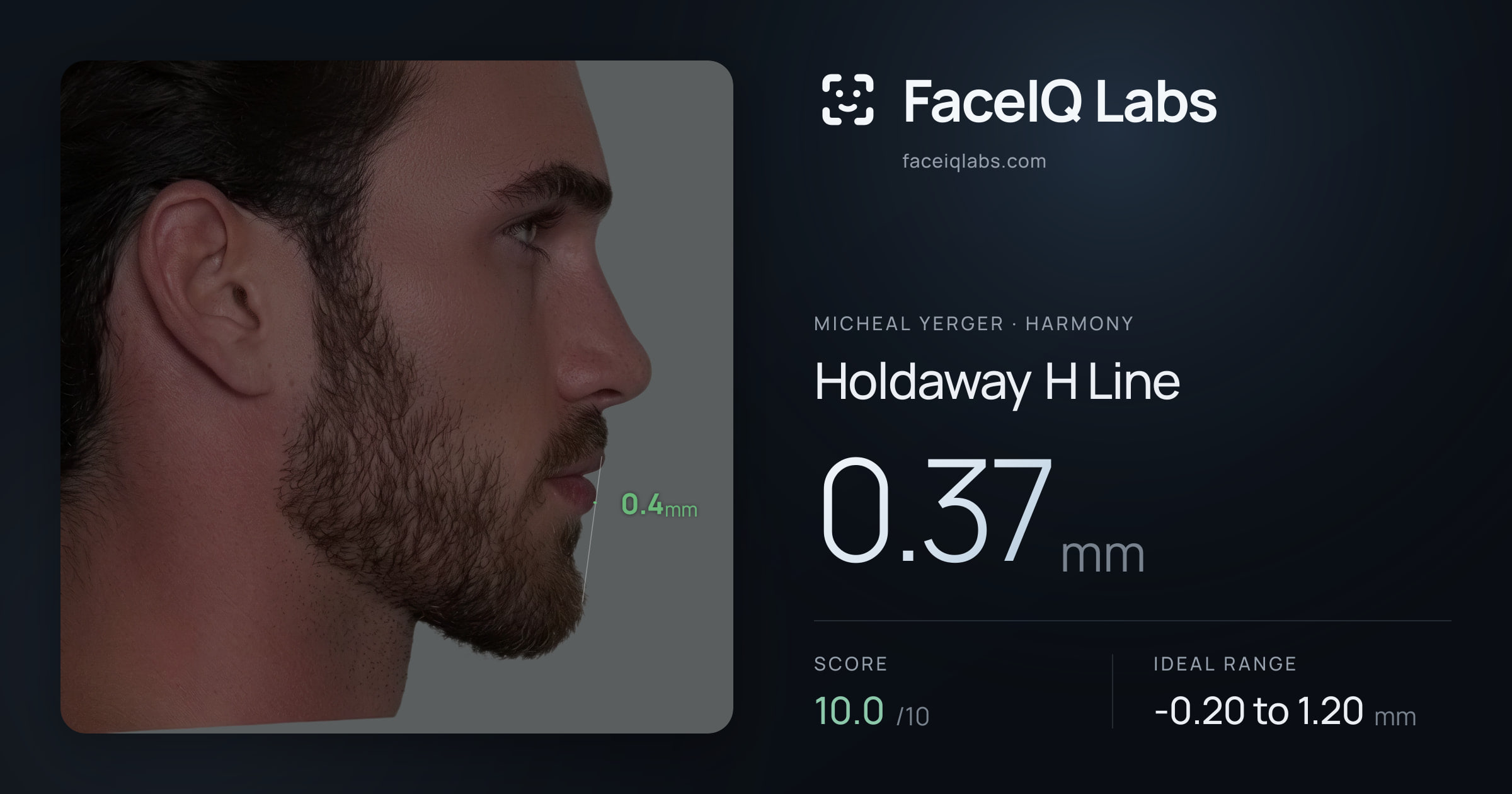 Micheal Yerger Holdaway H Line: 0.37mm, drawn on the photo