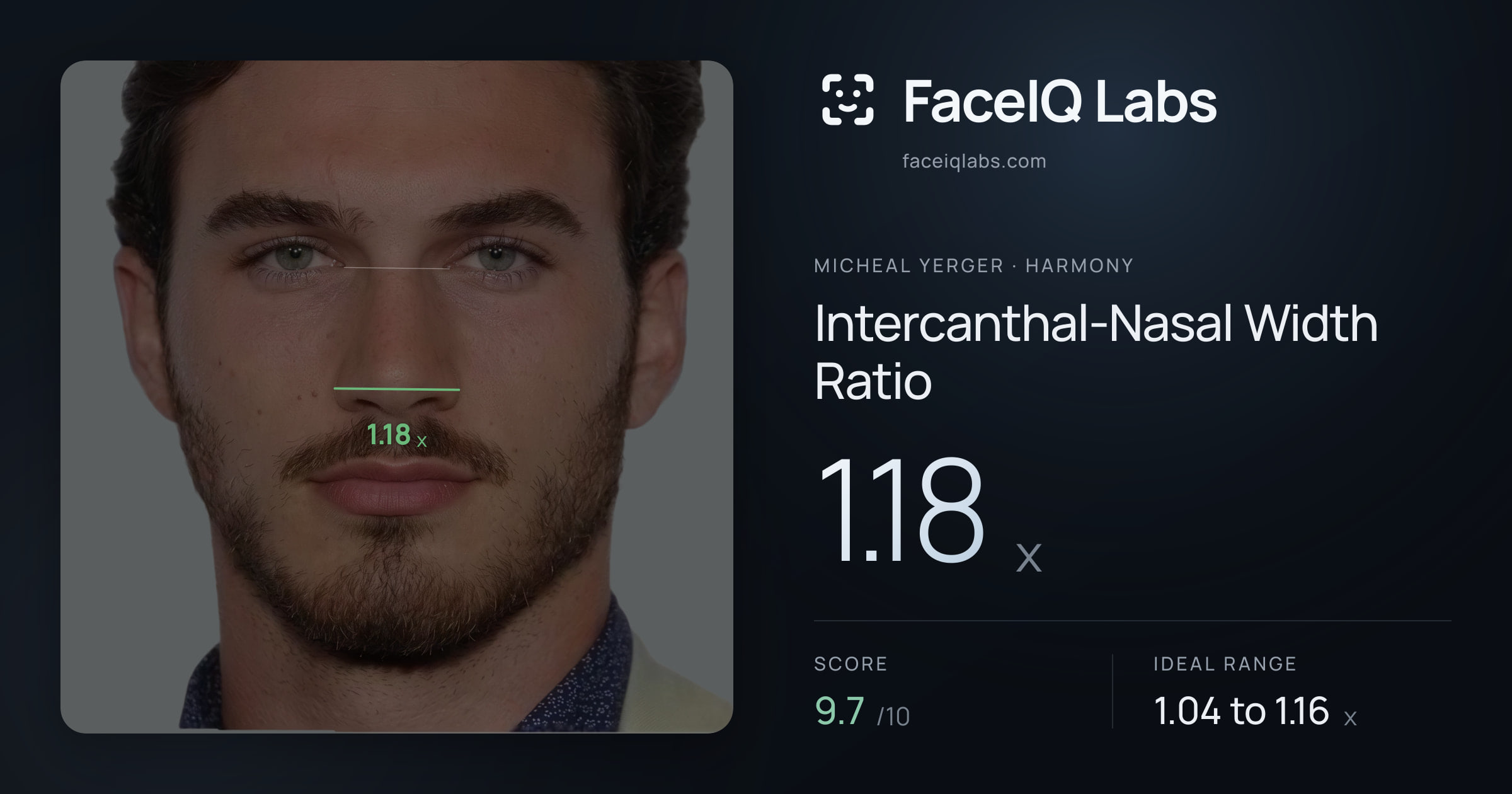Micheal Yerger Intercanthal-Nasal Width Ratio: 1.18x, drawn on the photo