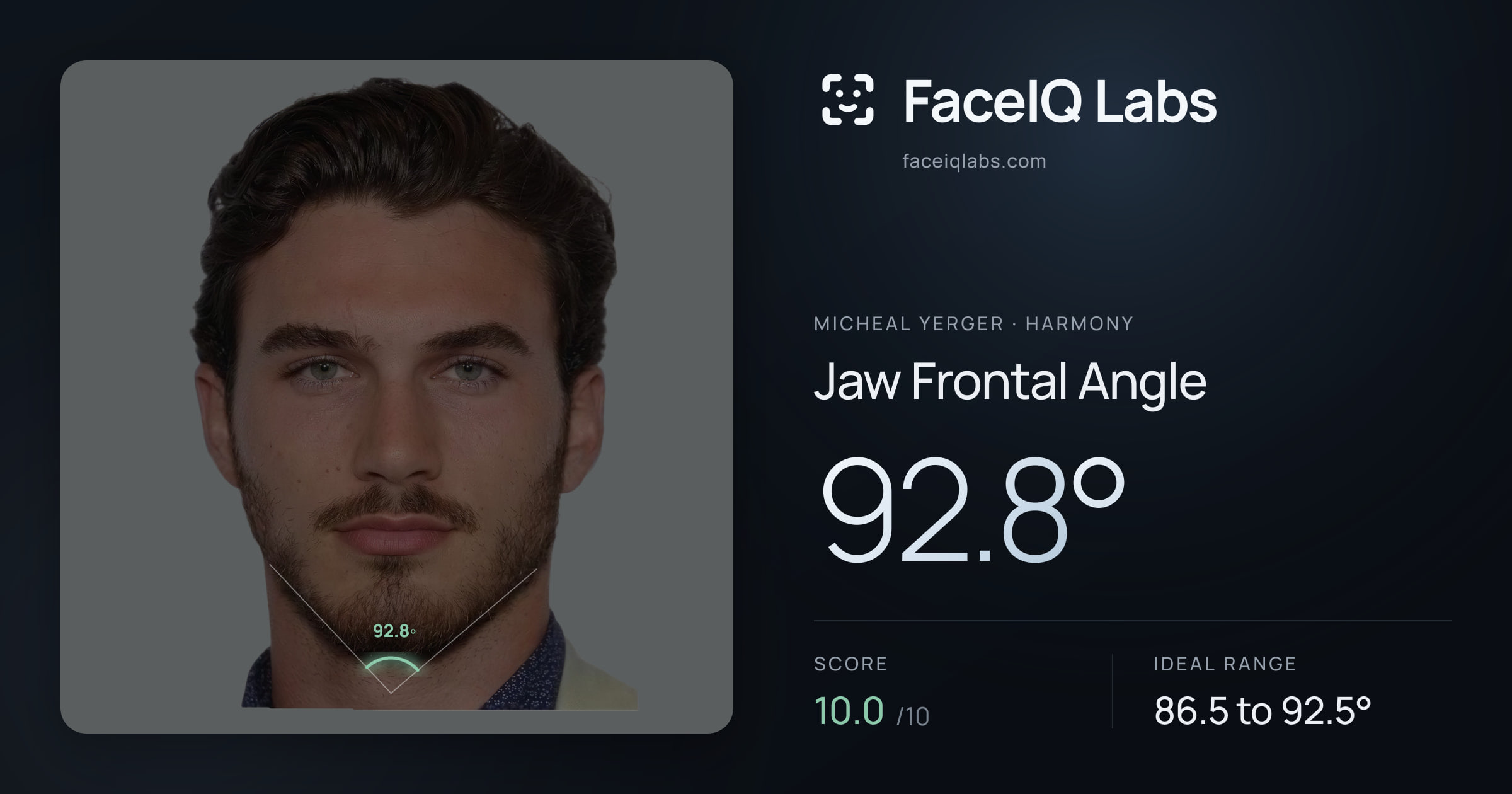 Micheal Yerger Jaw Frontal Angle: 92.8°, drawn on the photo