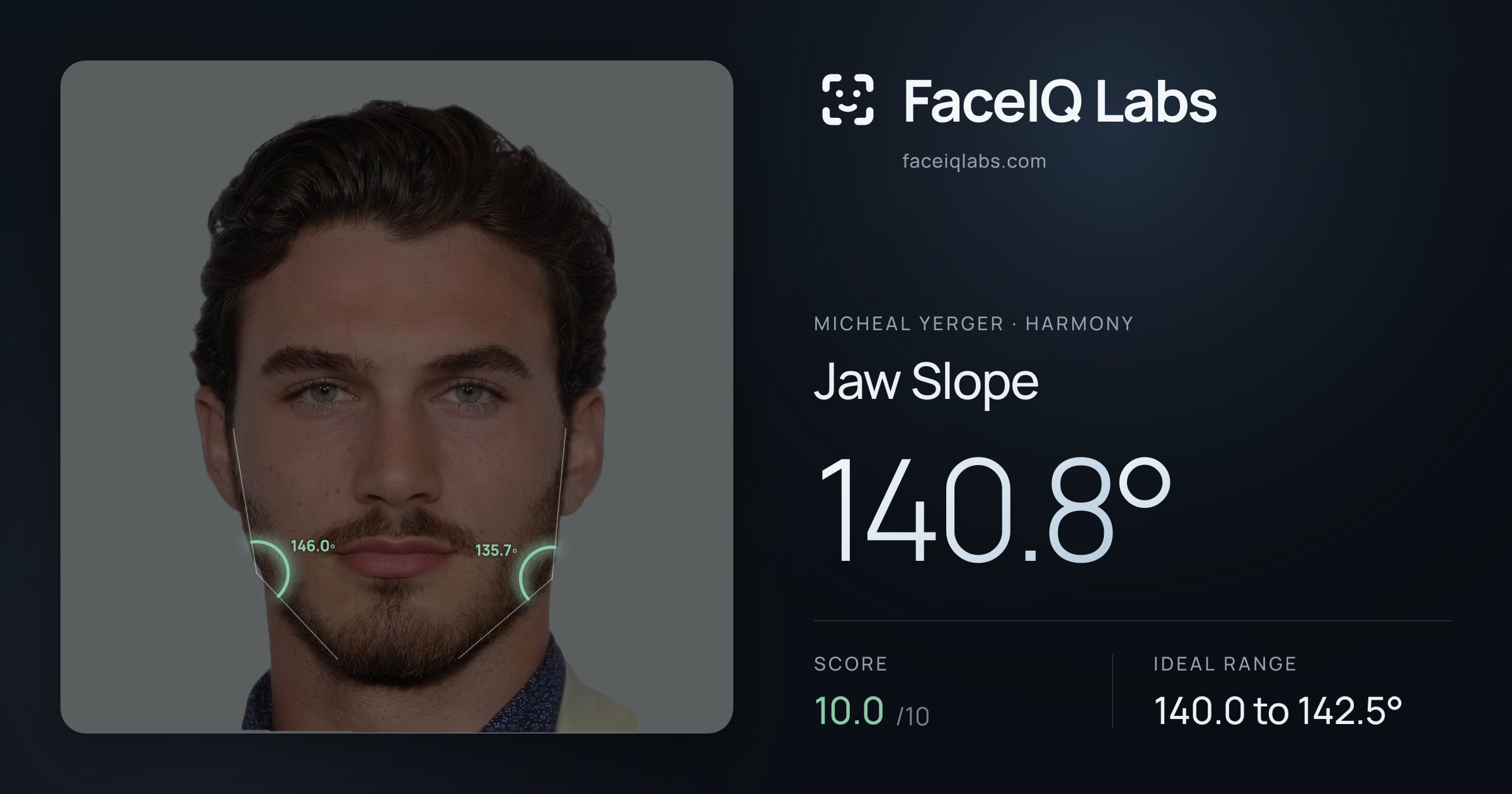 Micheal Yerger Jaw Slope: 140.8°, drawn on the photo