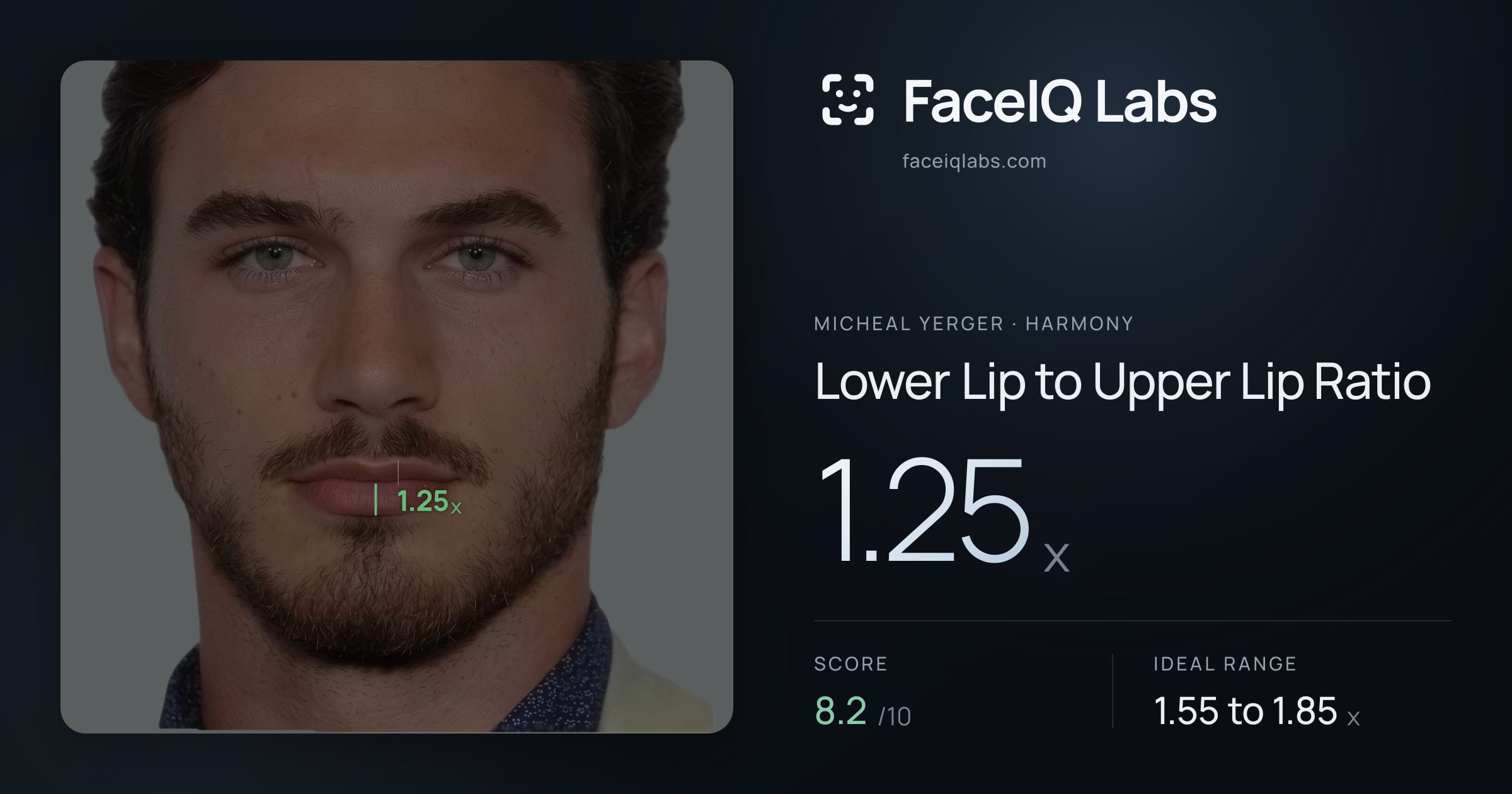 Micheal Yerger Lower Lip to Upper Lip Ratio: 1.25x, drawn on the photo