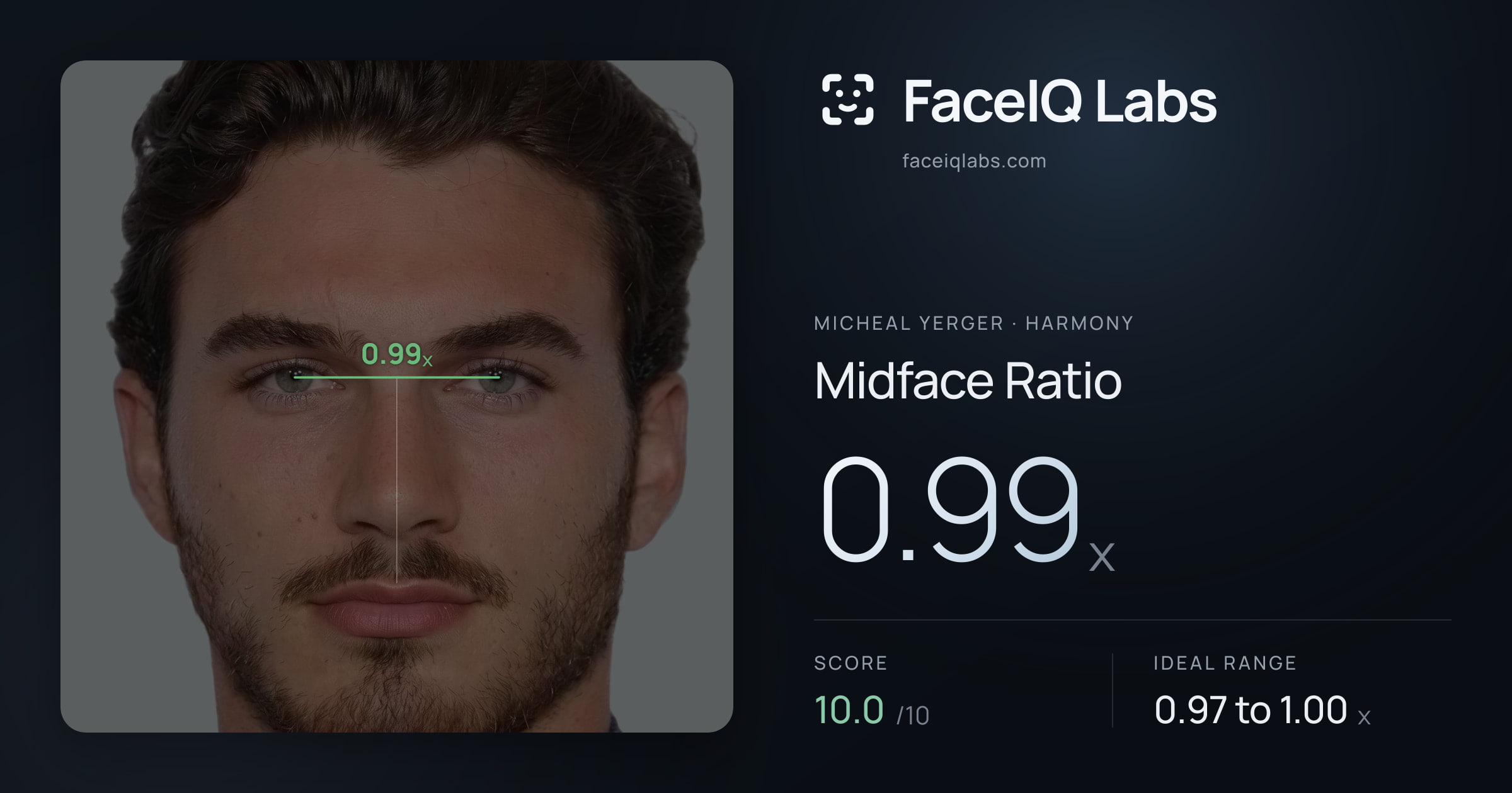 Micheal Yerger Midface Ratio: 0.99x, drawn on the photo