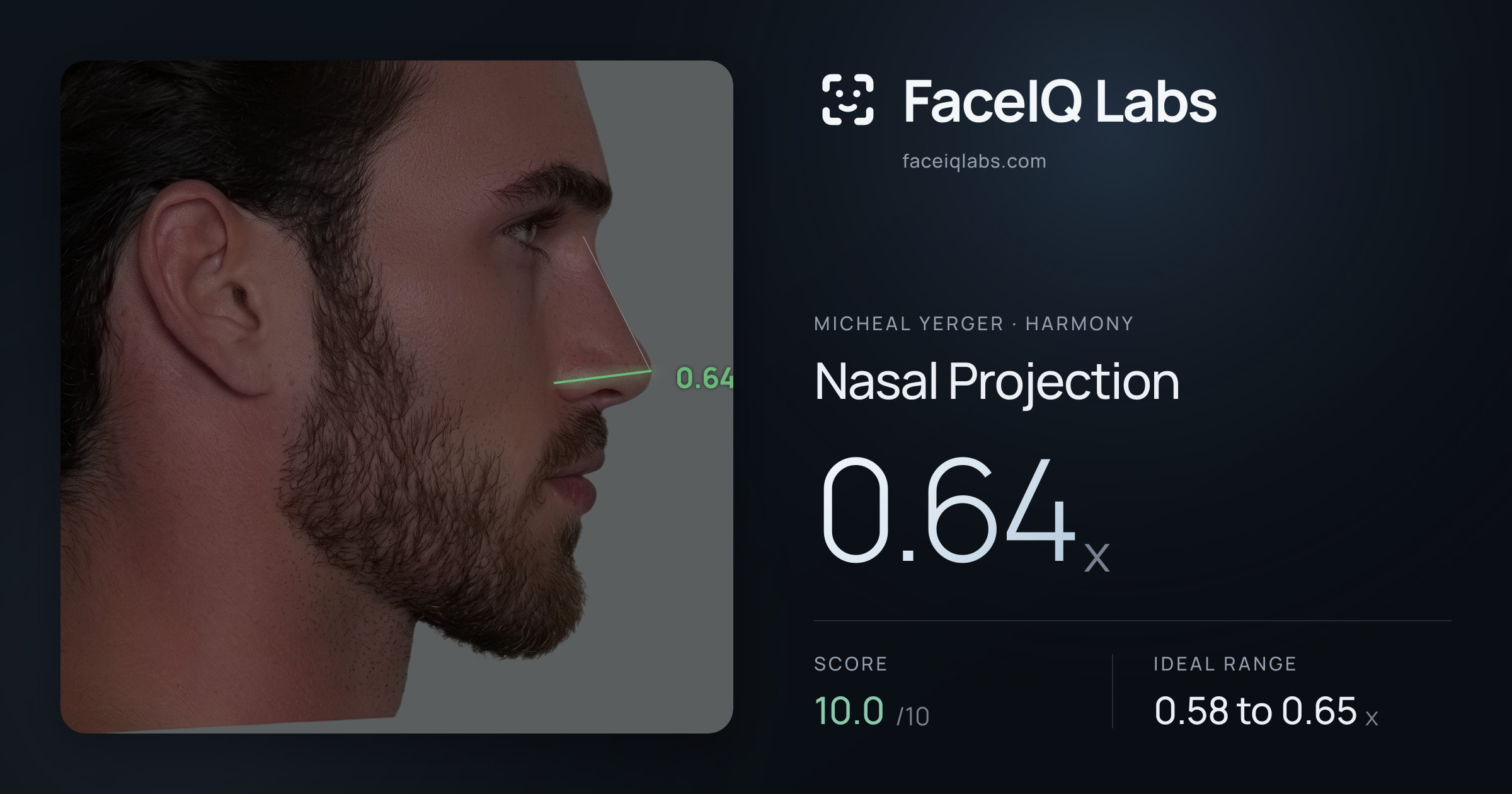 Micheal Yerger Nasal Projection: 0.64x, drawn on the photo