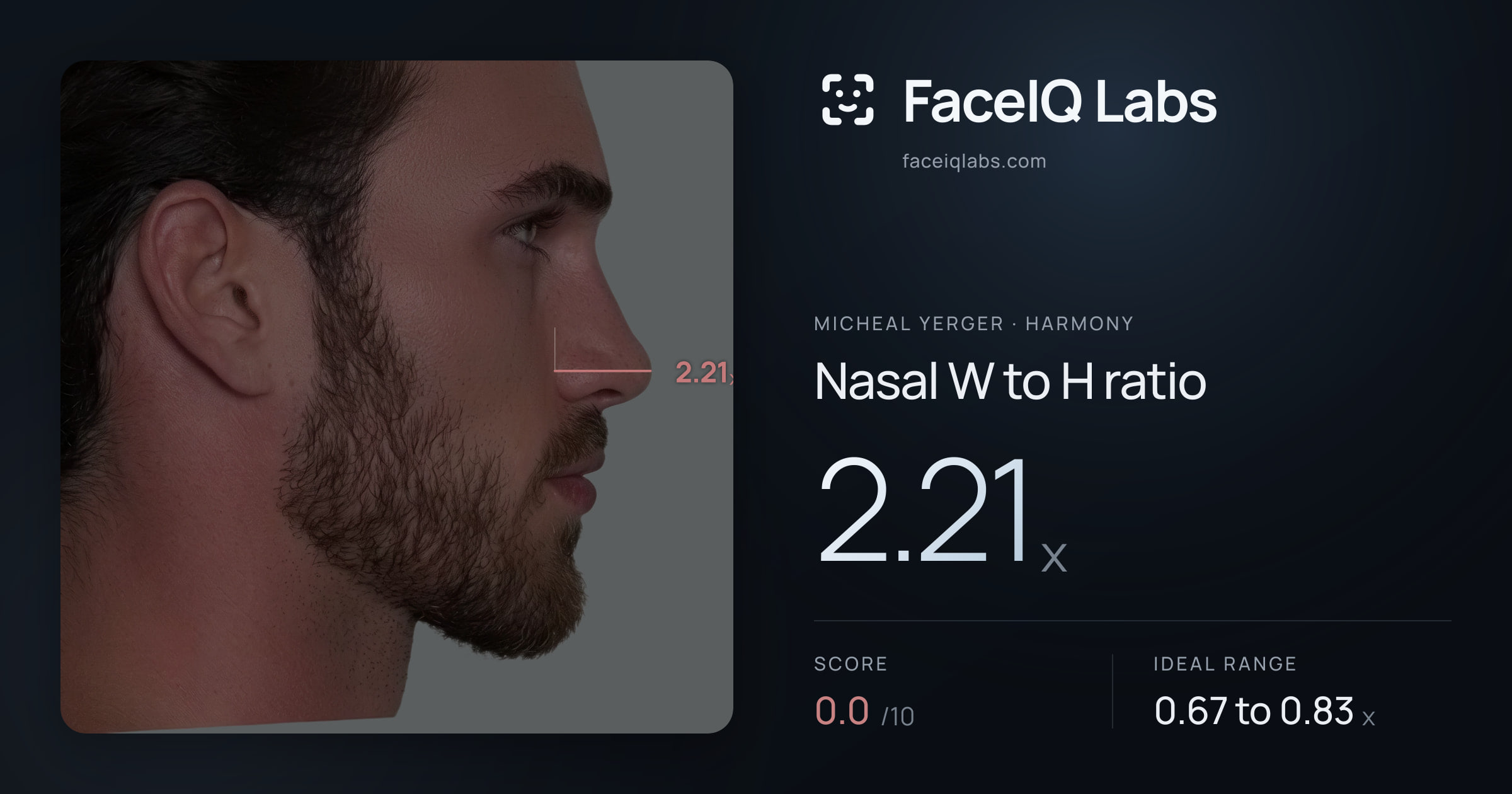 Micheal Yerger Nasal W to H ratio: 2.21x, drawn on the photo