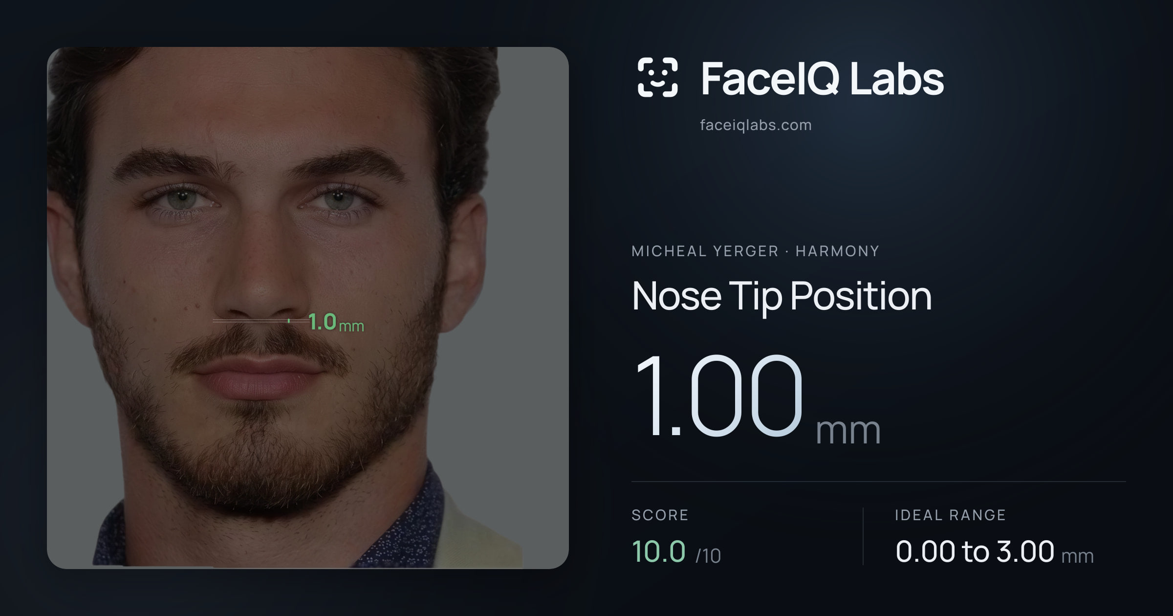 Micheal Yerger Nose Tip Position: 1.00mm, drawn on the photo