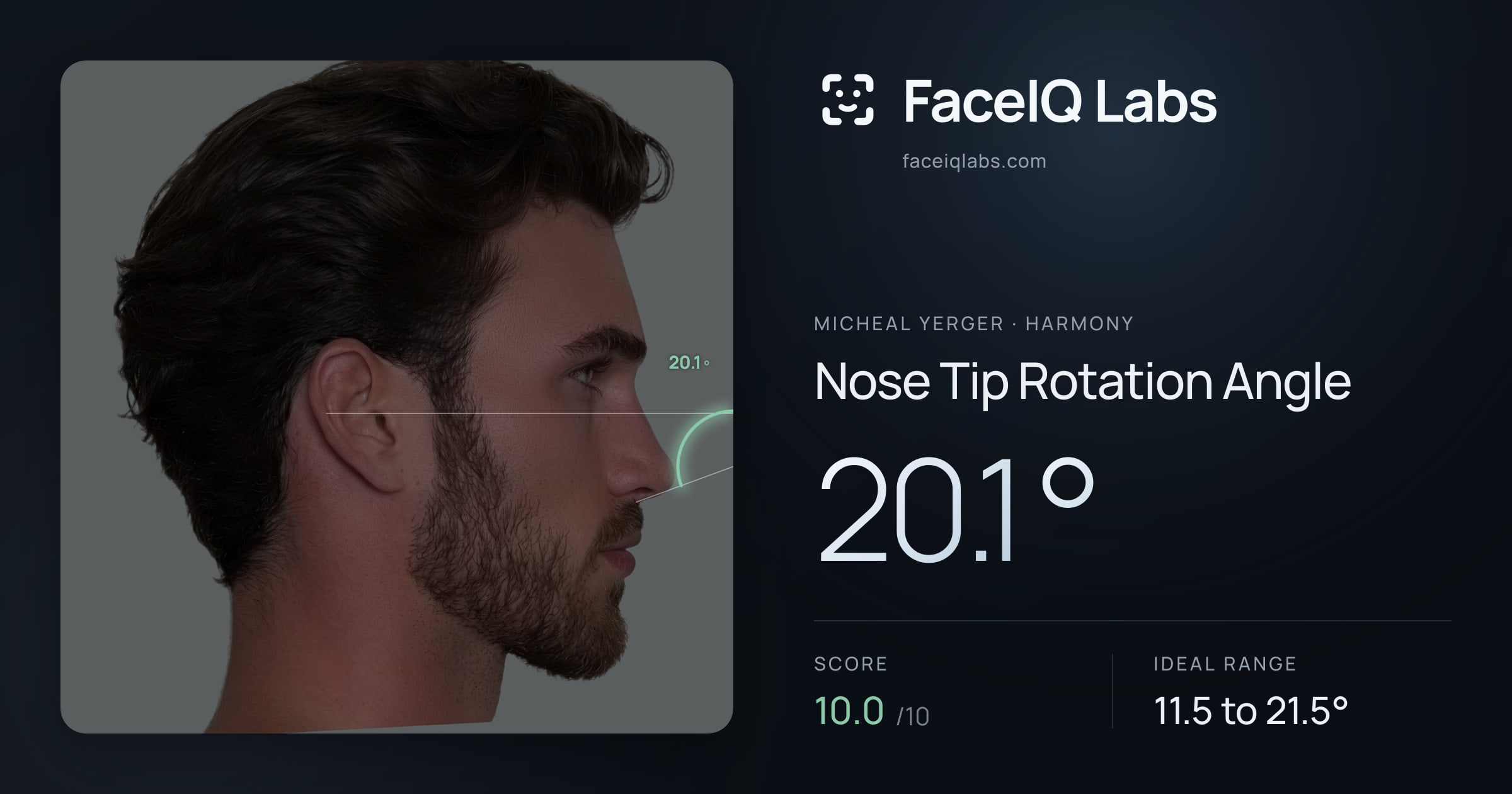 Micheal Yerger Nose Tip Rotation Angle: 20.1°, drawn on the photo